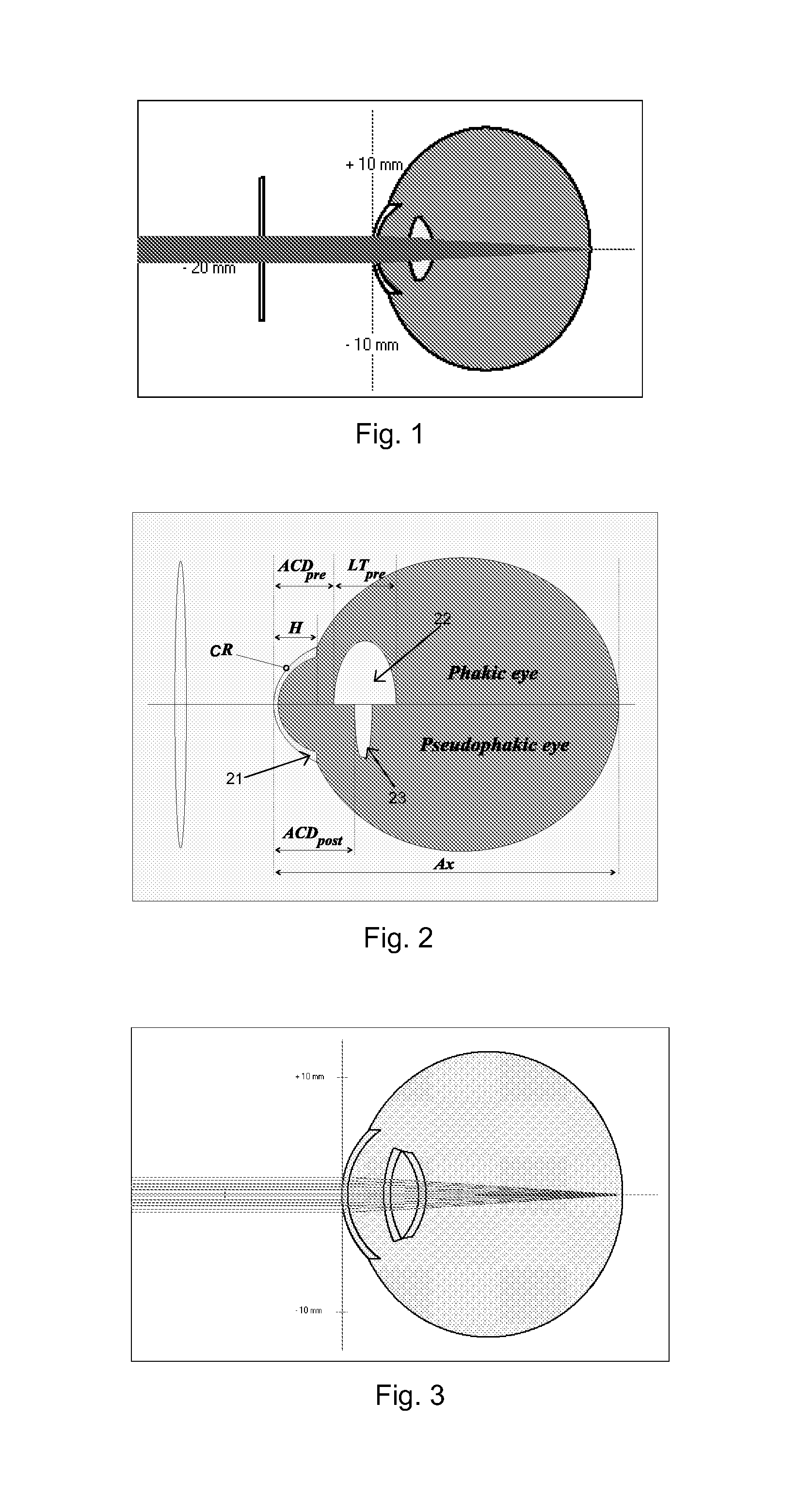 System and Method for Determining and Predicting IOL Power in Situ