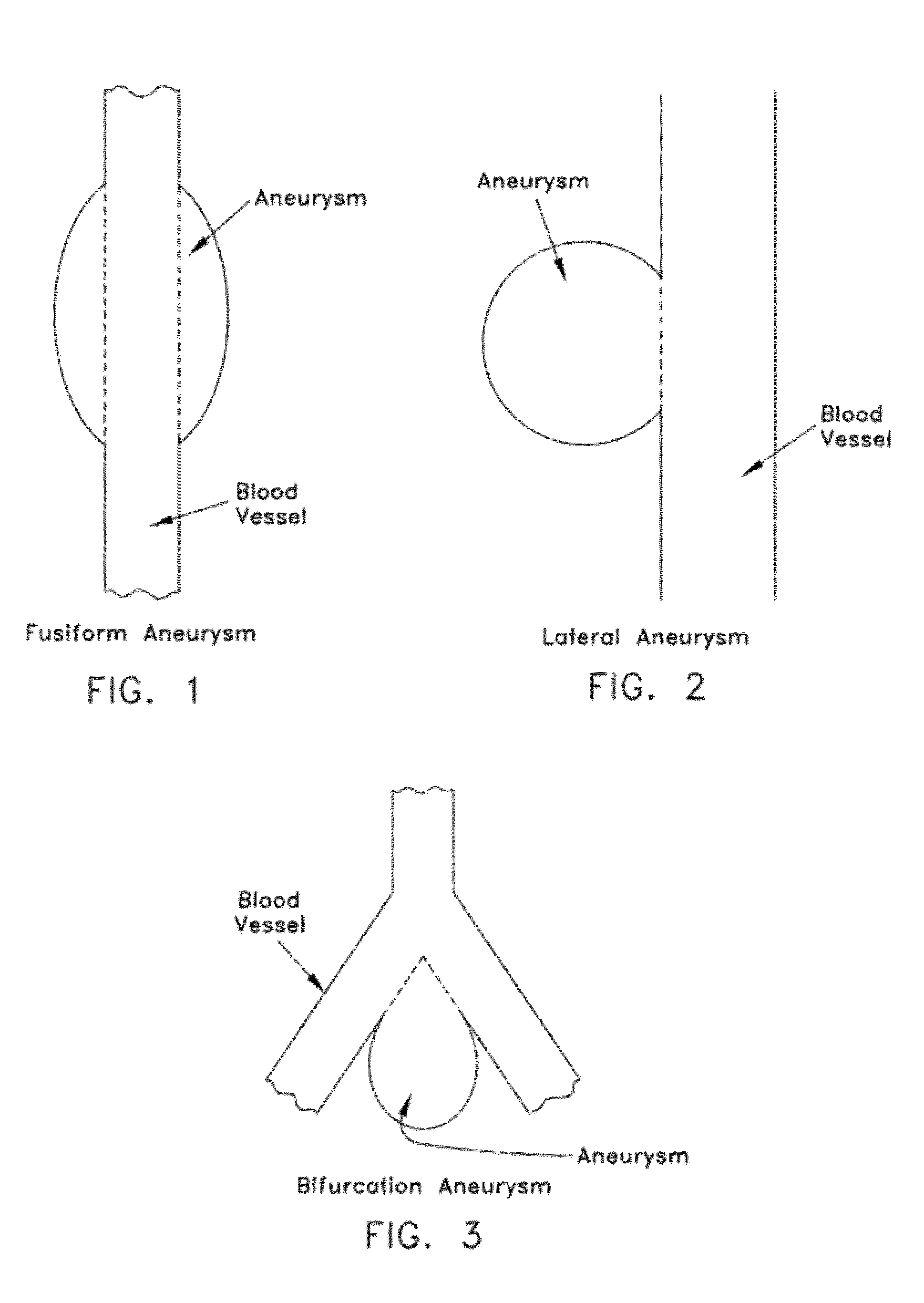 Method and apparatus for restricting flow through an opening in the side wall of a body lumen, and/or for reinforcing a weakness in the side wall of a body lumen, while still maintaining substantially normal flow through the body lumen
