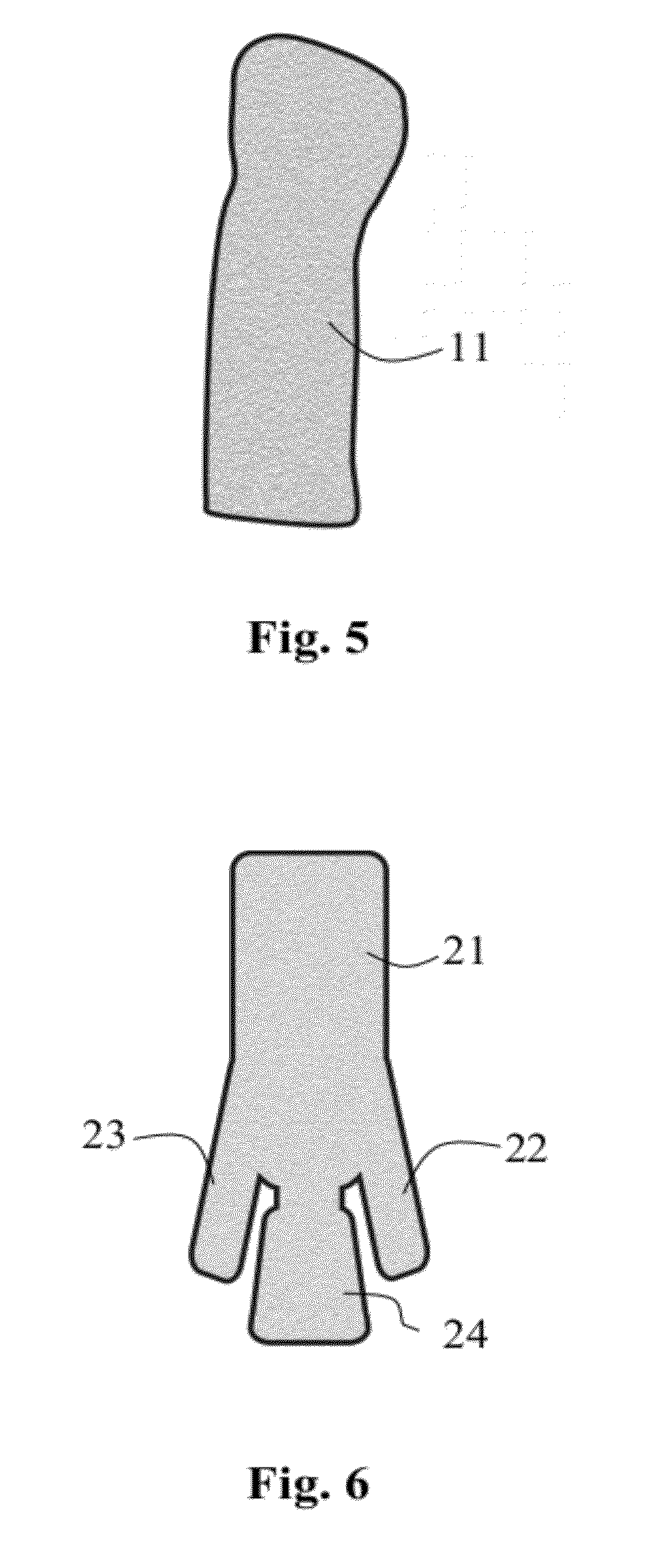 Novel composite materials comprising a thermoplastic matrix polymer and wood particles