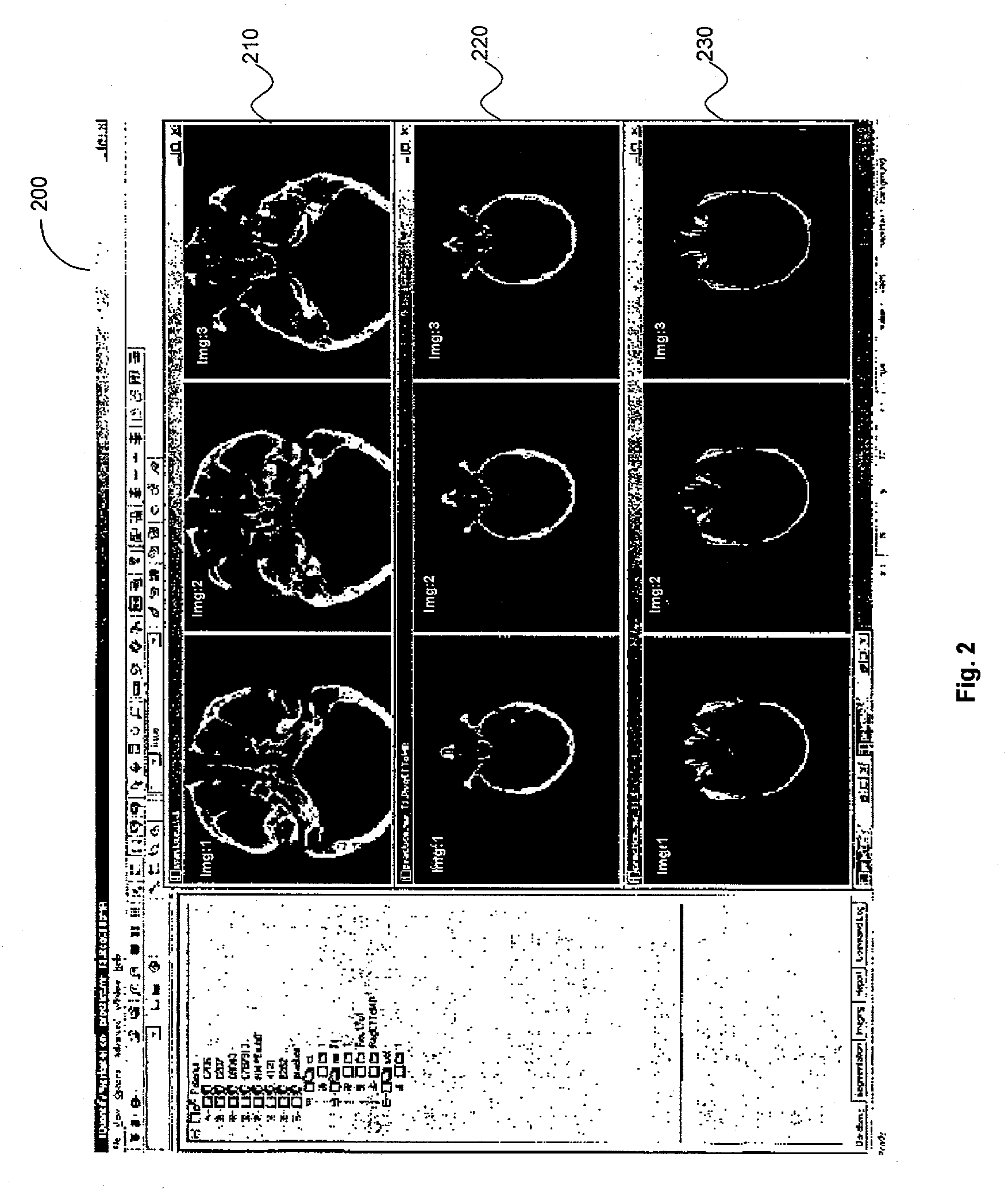 System and method for determining convergence of image set registration