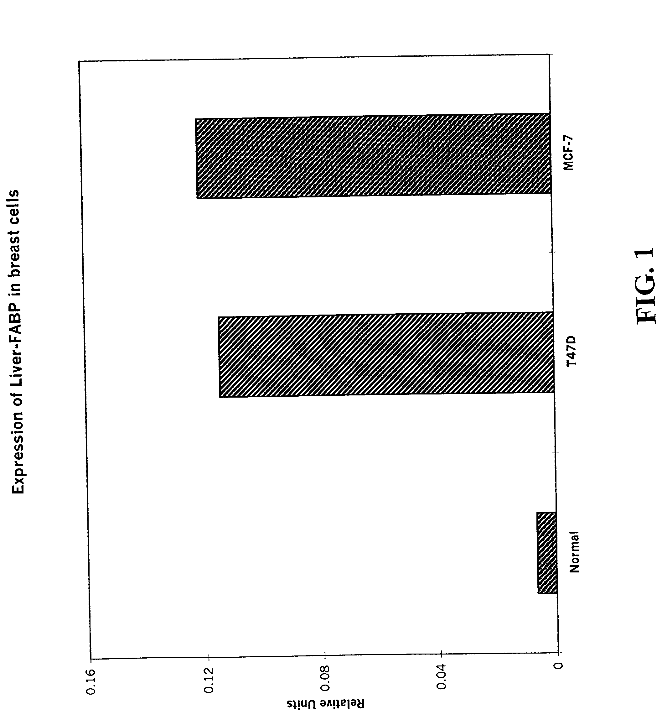 Method of diagnosing stage or aggressiveness of breast and prostate cancer based on levels of fatty acid binding proteins