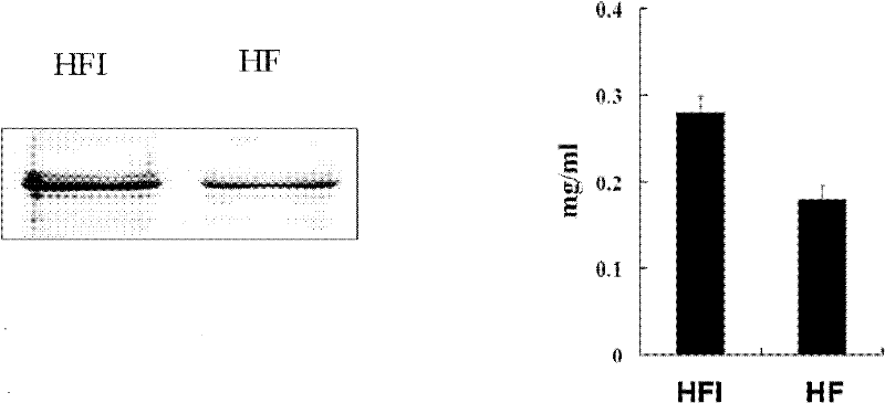 Fusion protein of Her2 antibody and interleukin 2 and application thereof