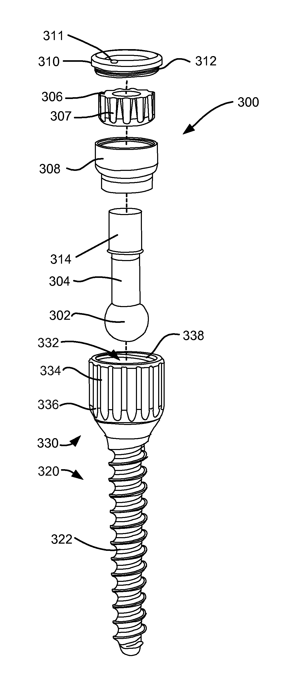 Load-sharing bone anchor having a deflectable post and method for dynamic stabilization of the spine