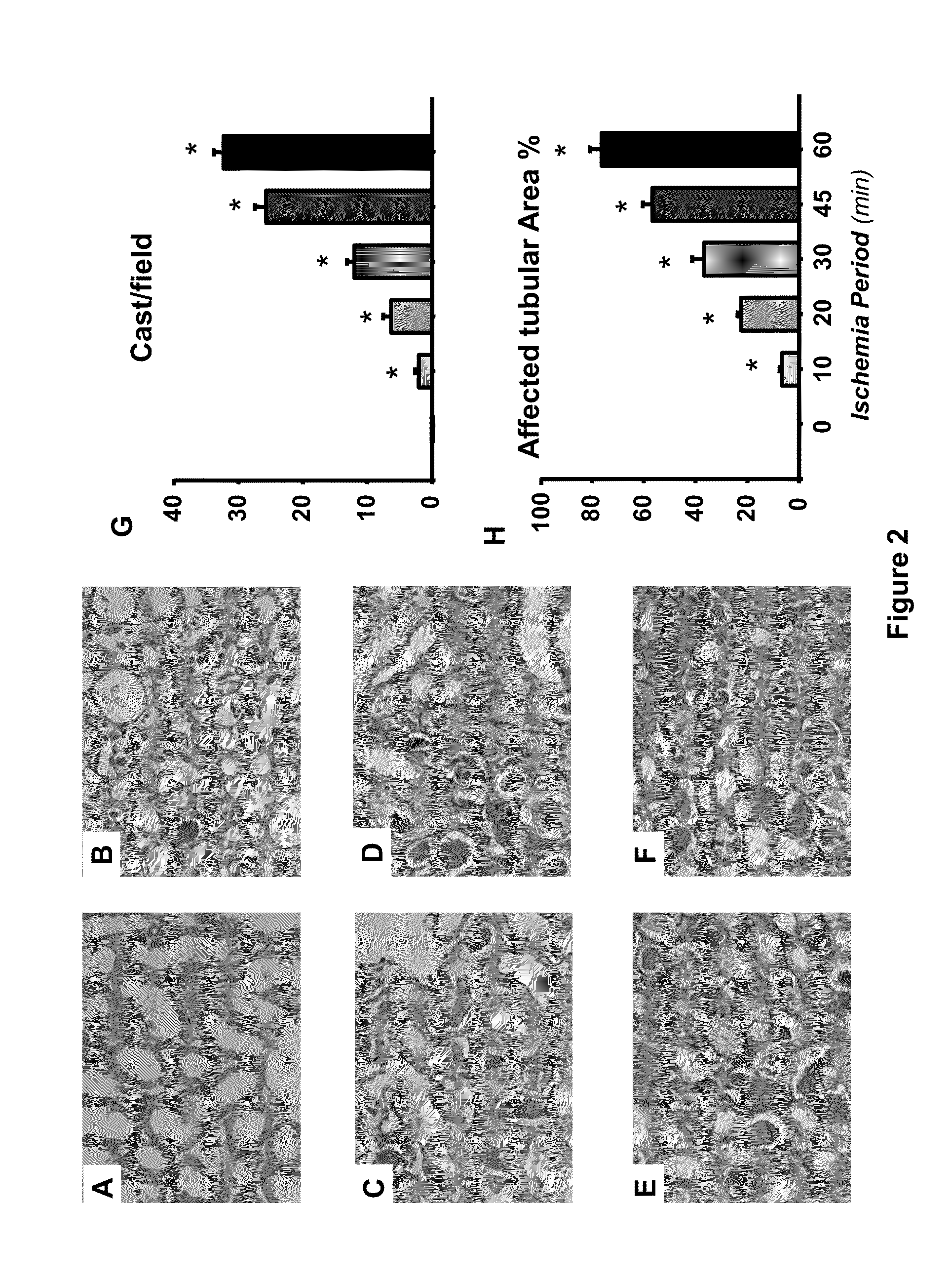 Diagnostic method for detecting acute kidney injury using heat shock protein 72 as a sensitive biomarker