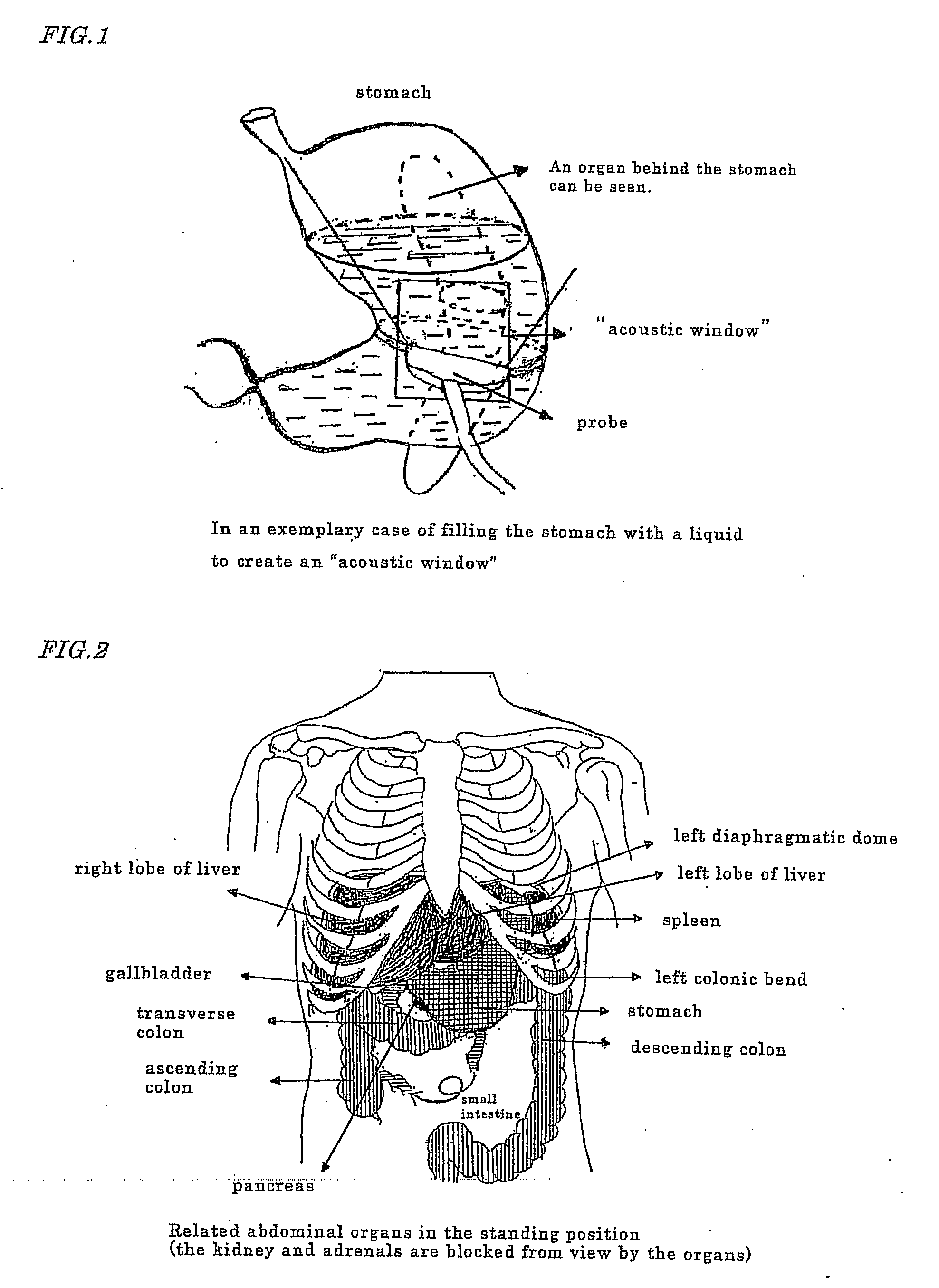 Novel method of using triacetin and auxiliary agent for ultrasonic diagnostic examination