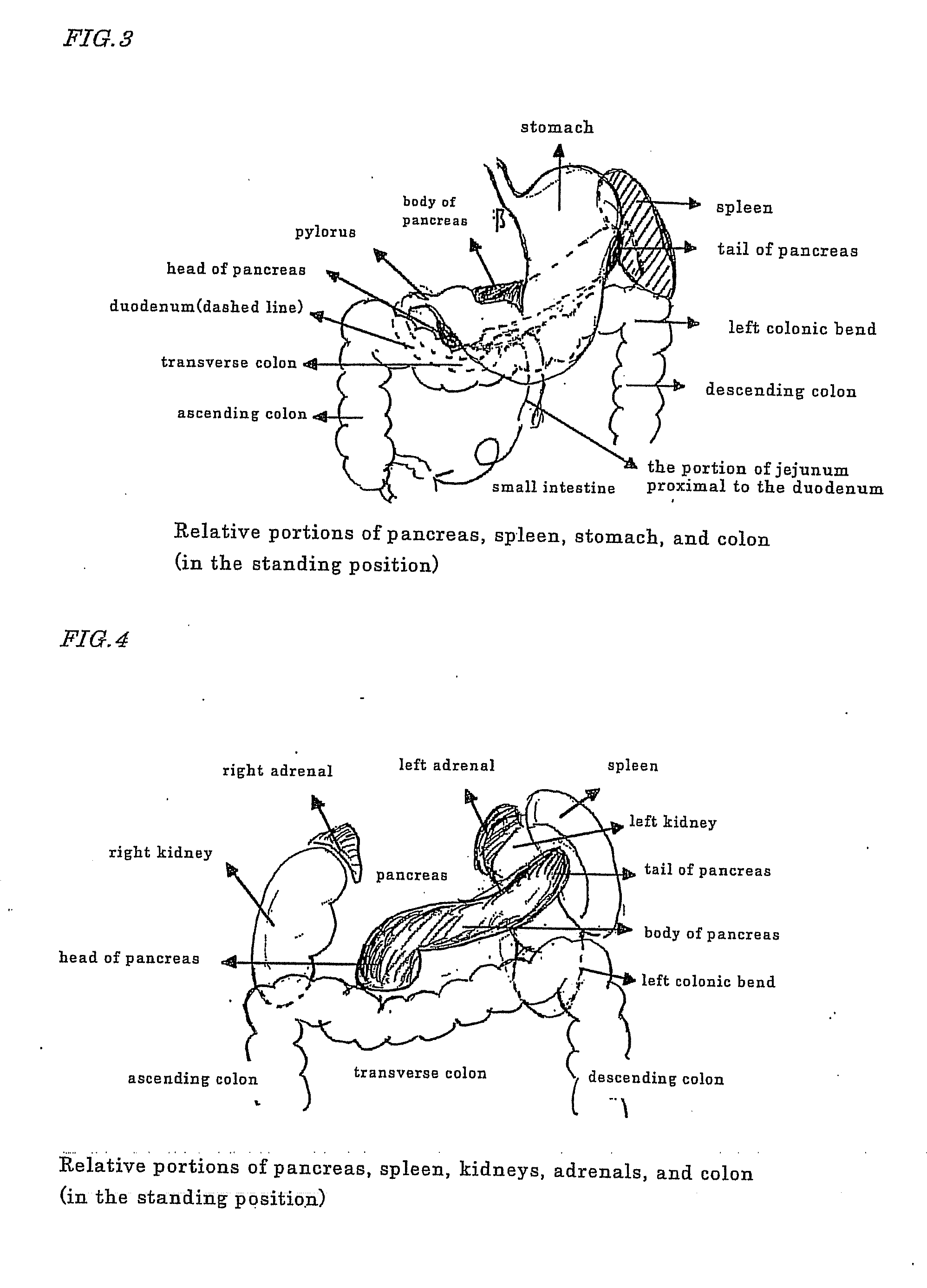 Novel method of using triacetin and auxiliary agent for ultrasonic diagnostic examination