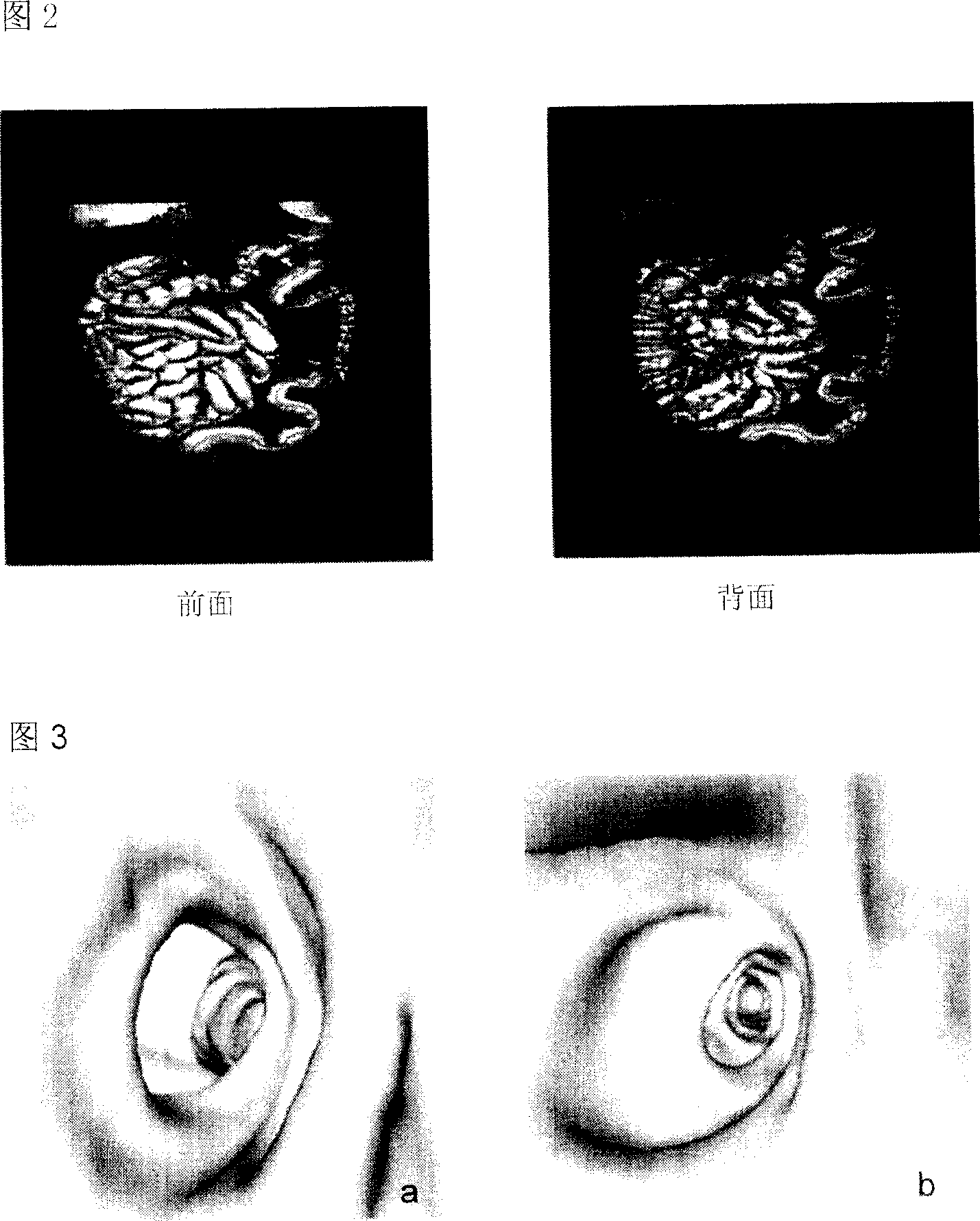 Center line automatic locating method of virtual endoscope system