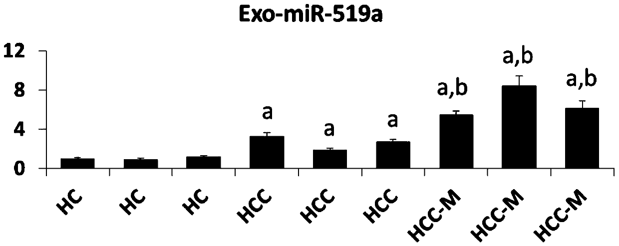 Blood exosome molecular marker and application thereof in preparation of liver cancer diagnostic products
