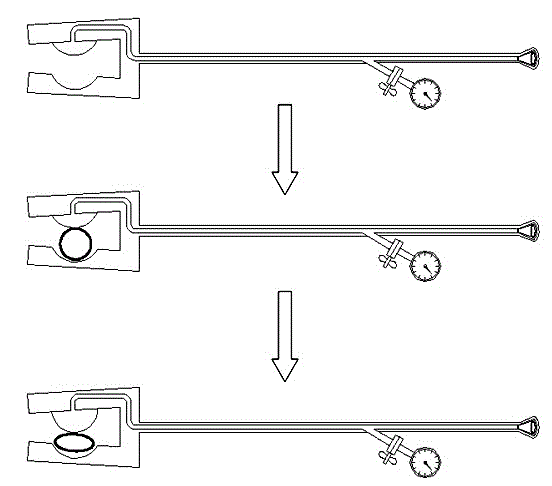 Renal artery directional blocking device