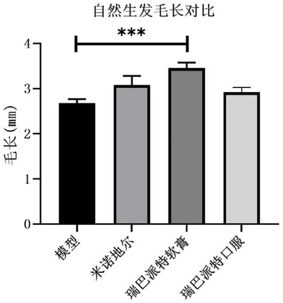 Application of rebamipide to alopecia prevention and hair growth