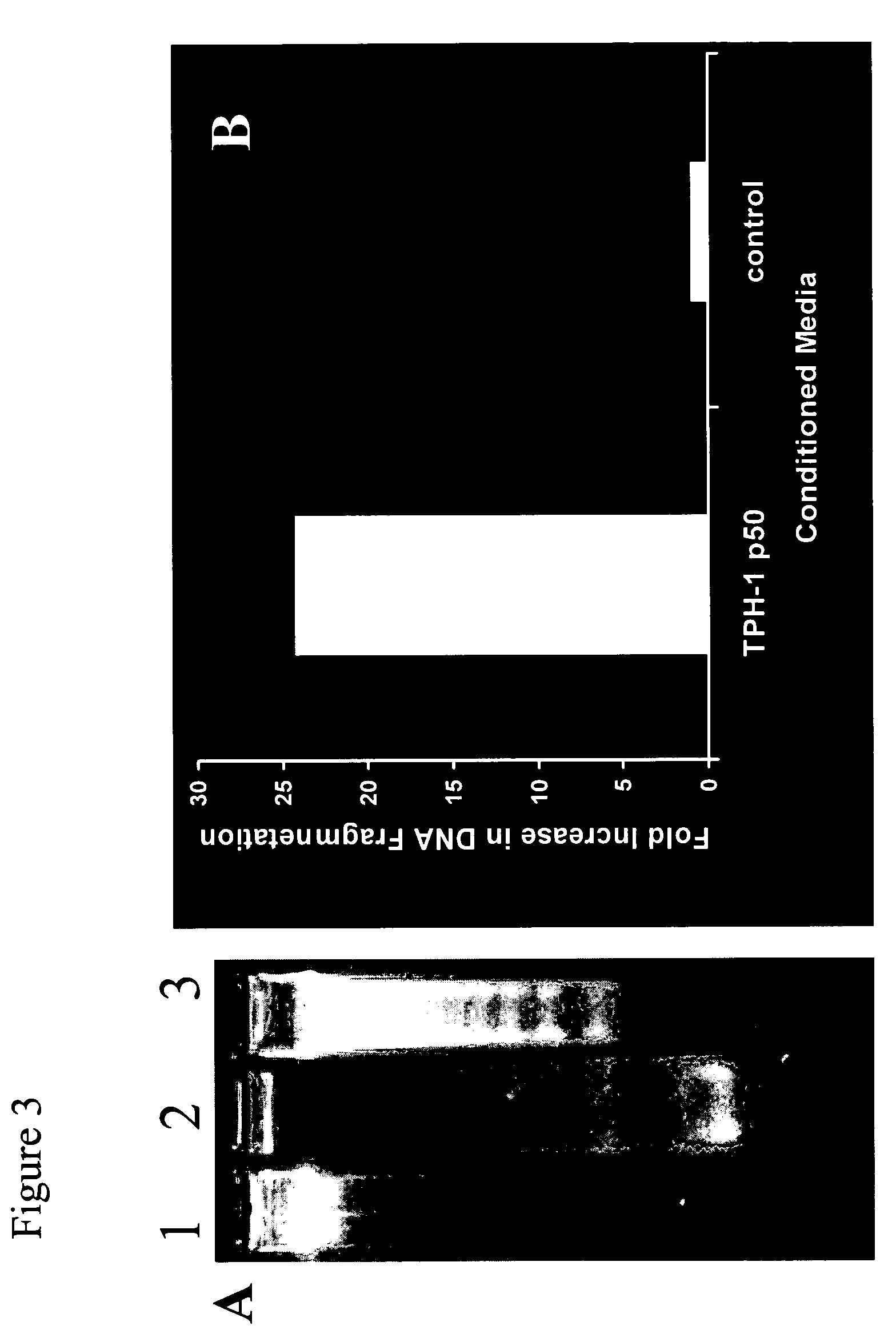 Compositions and methods for inhibiting liver stellate cell growth