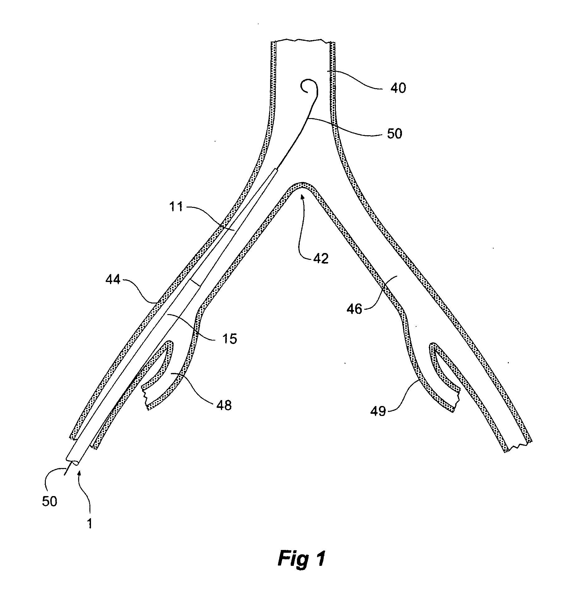 Introducer for a side branch device
