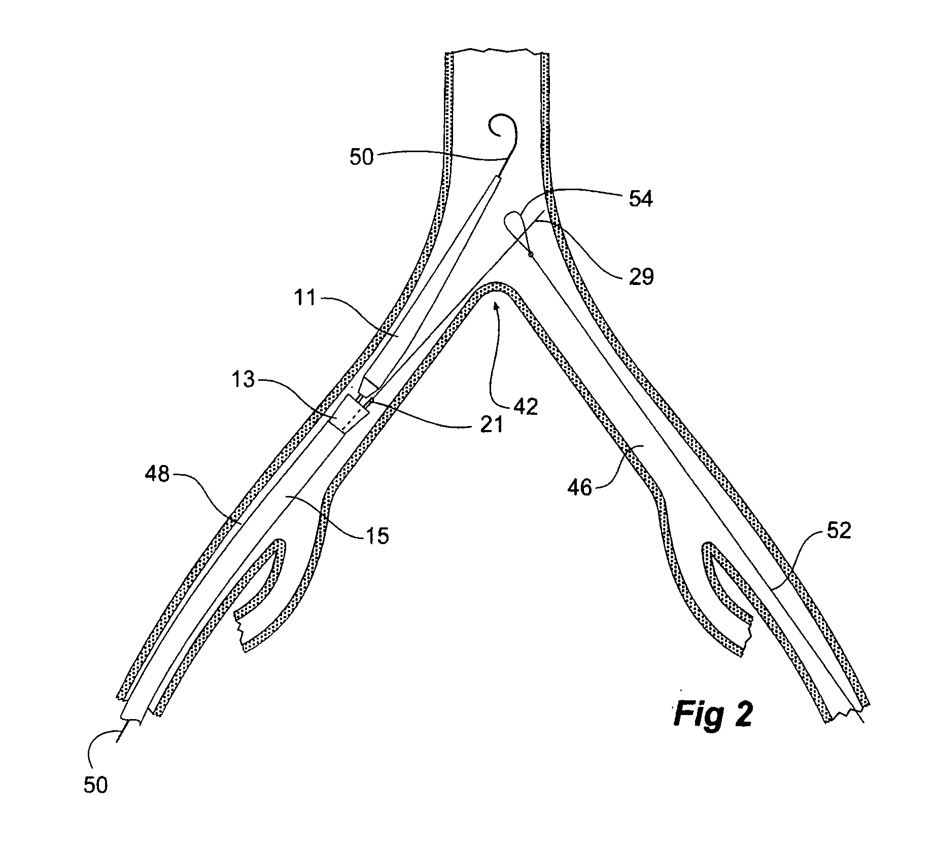 Introducer for a side branch device