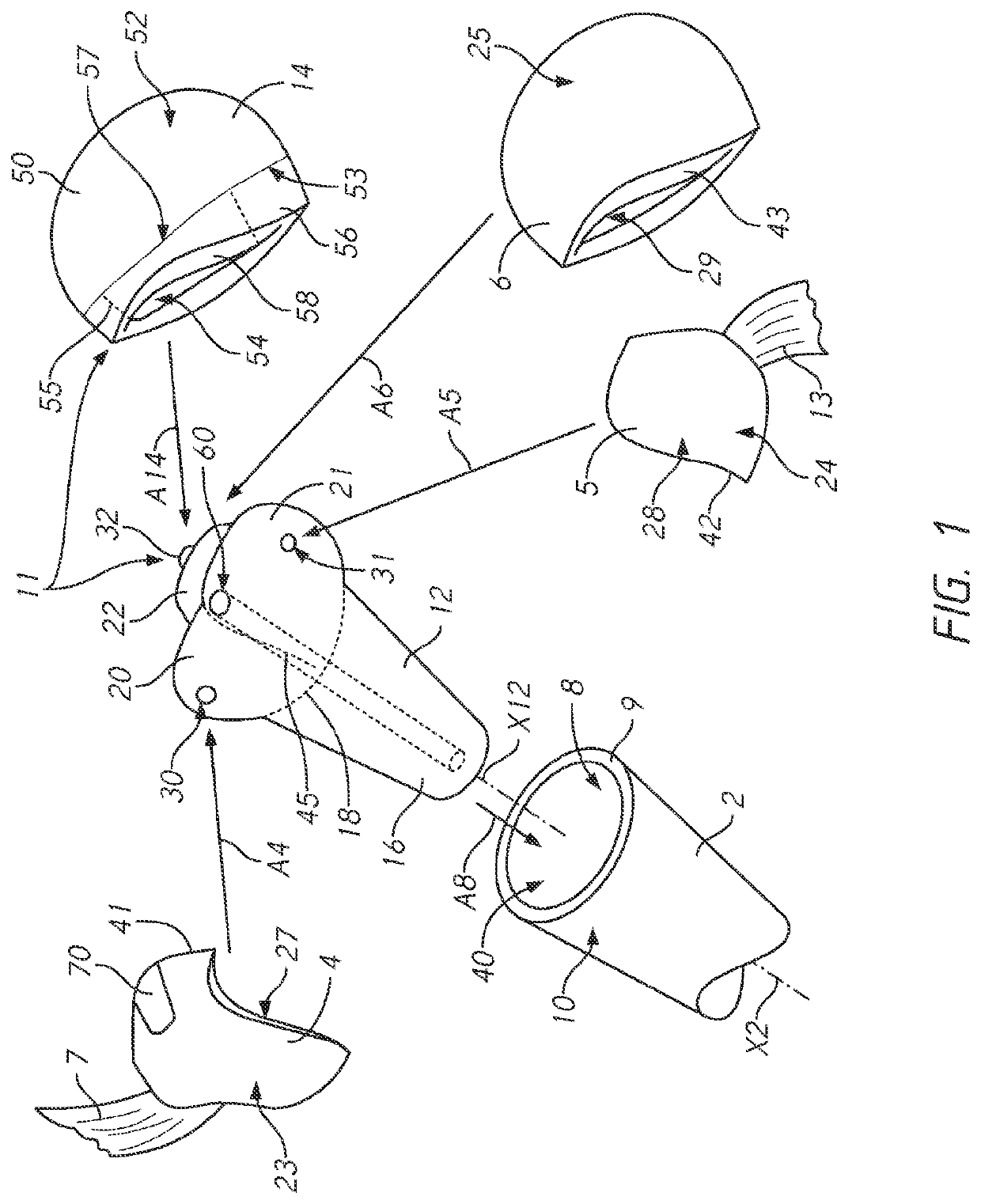 Patient-specific bone fracture prostheses and methods of making the same