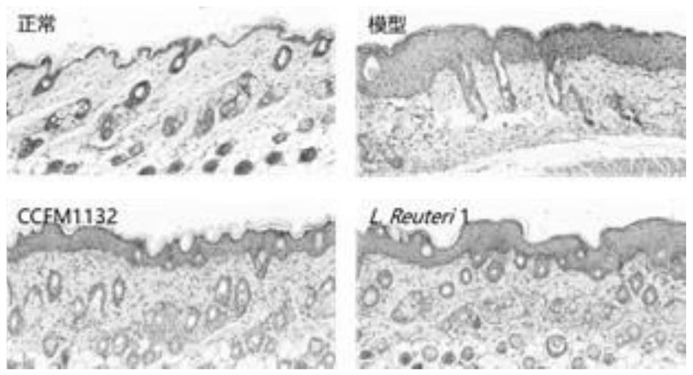 A strain of Lactobacillus reuteri capable of inhibiting the thickening of the cuticle of the skin and its application