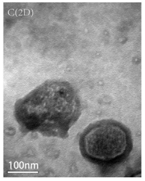 Dental pulp stem cell exosome as well as preparation method and application thereof