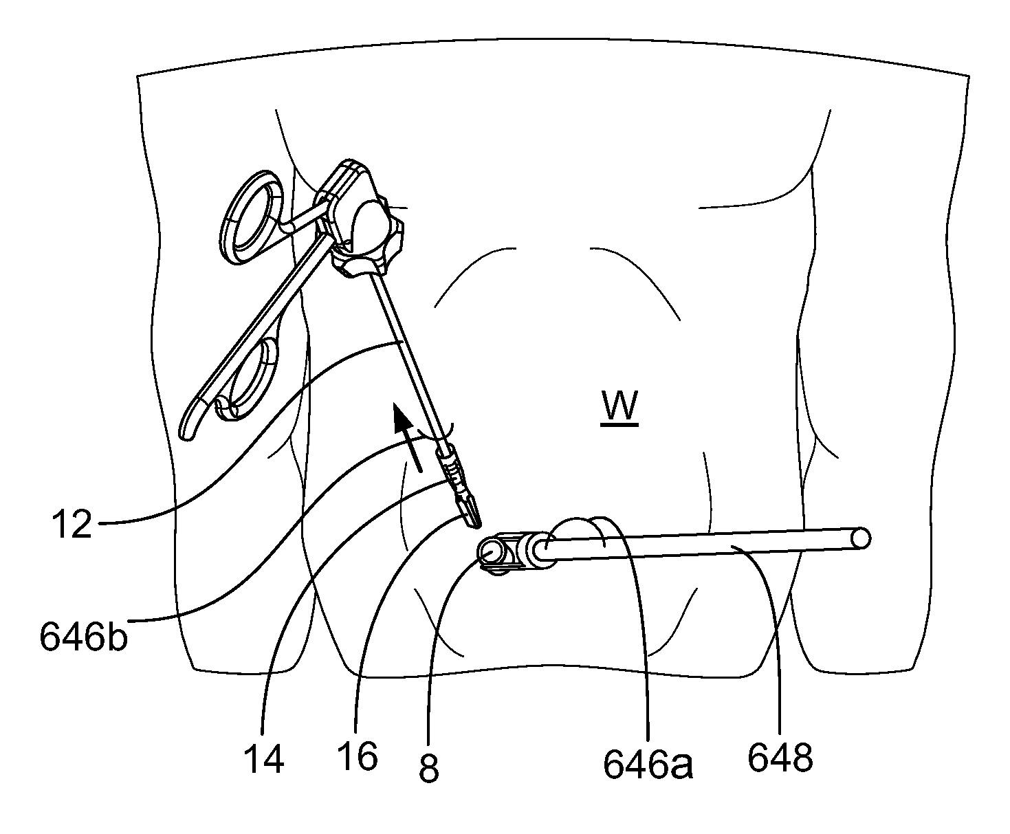 Surgical device and methods