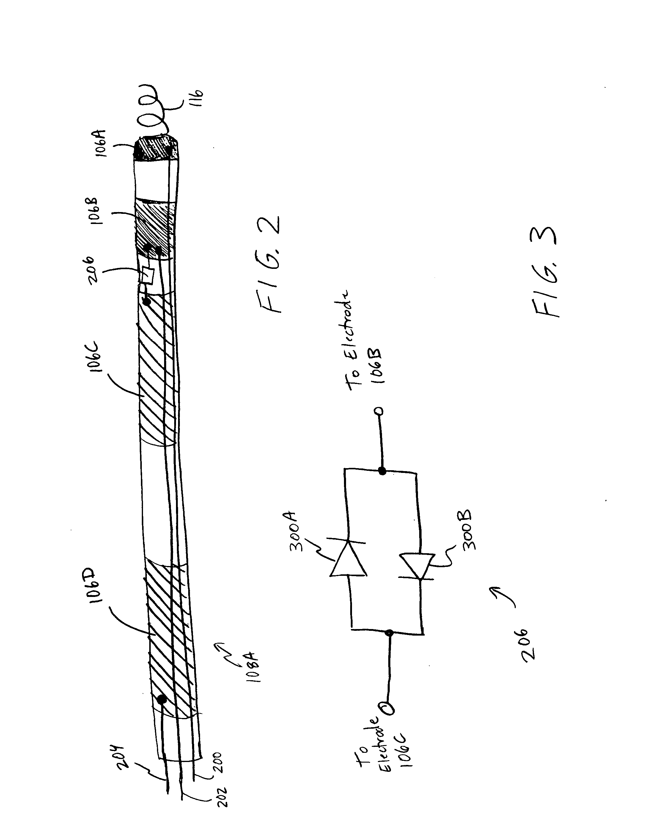 Semiconductor-gated cardiac lead and method of use