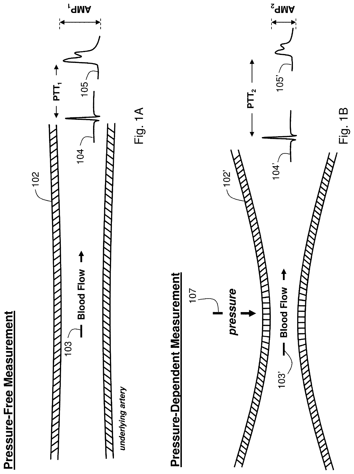 Body-worn system for measuring continuous non-invasive blood pressure (cNIBP)