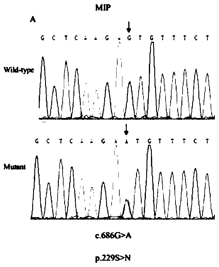 Application of substance for detecting MIP gene mutation in diagnosing giant panda cataracts