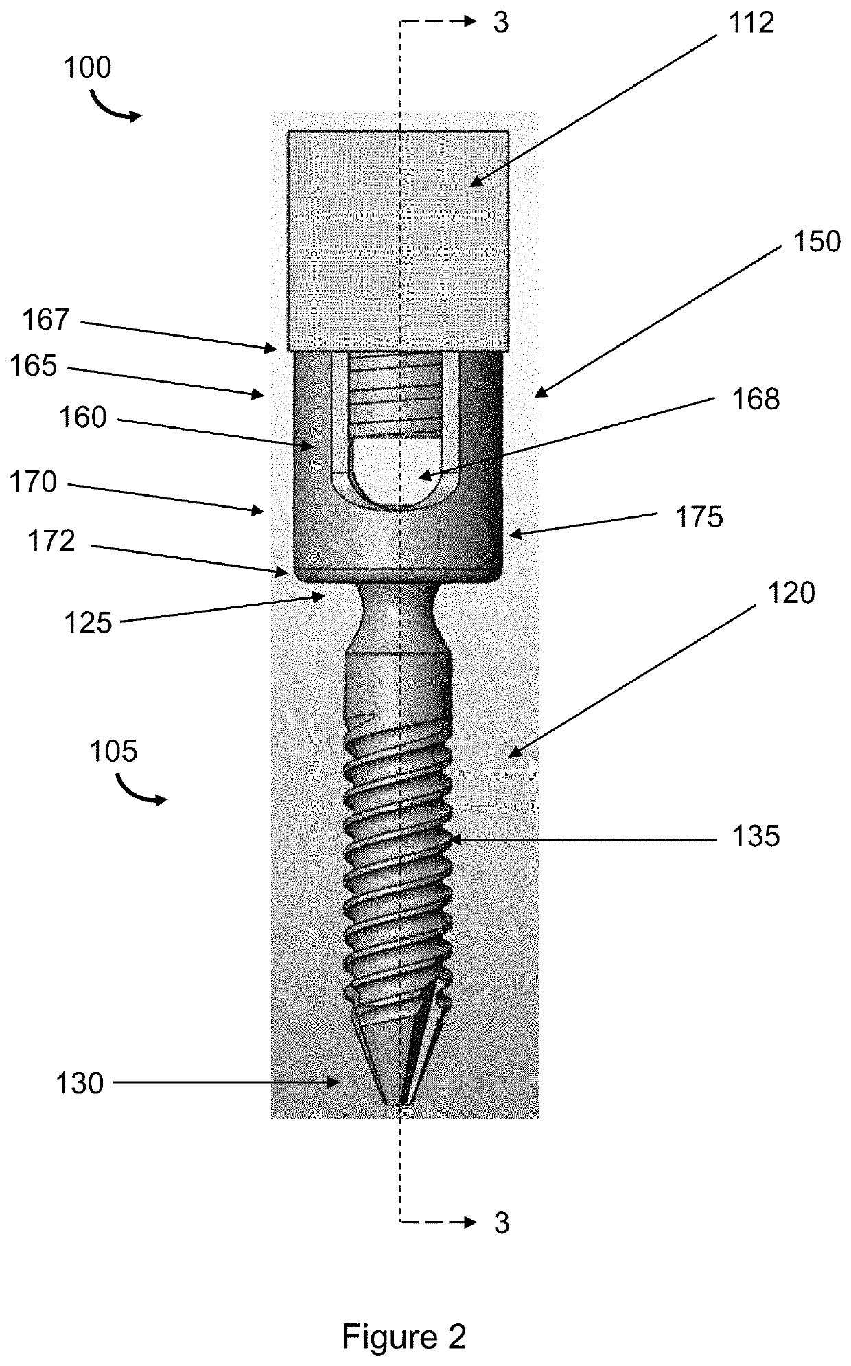 Device for Realignment, Stabilization, and Prevention of Progression of Abnormal Spine Curvature