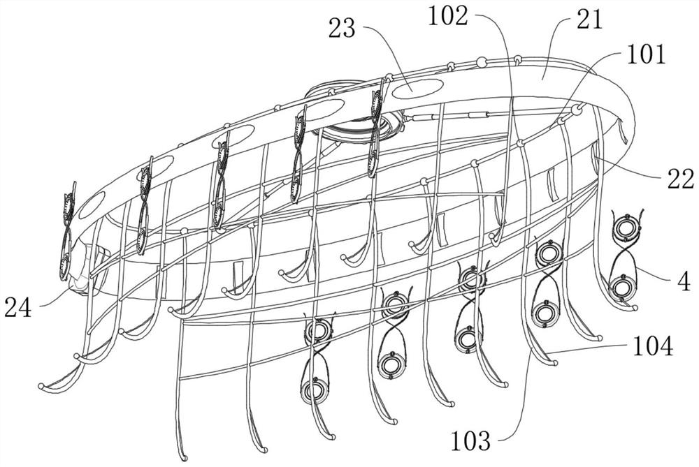 Artificial mitral valve suture-free automatic implantation device