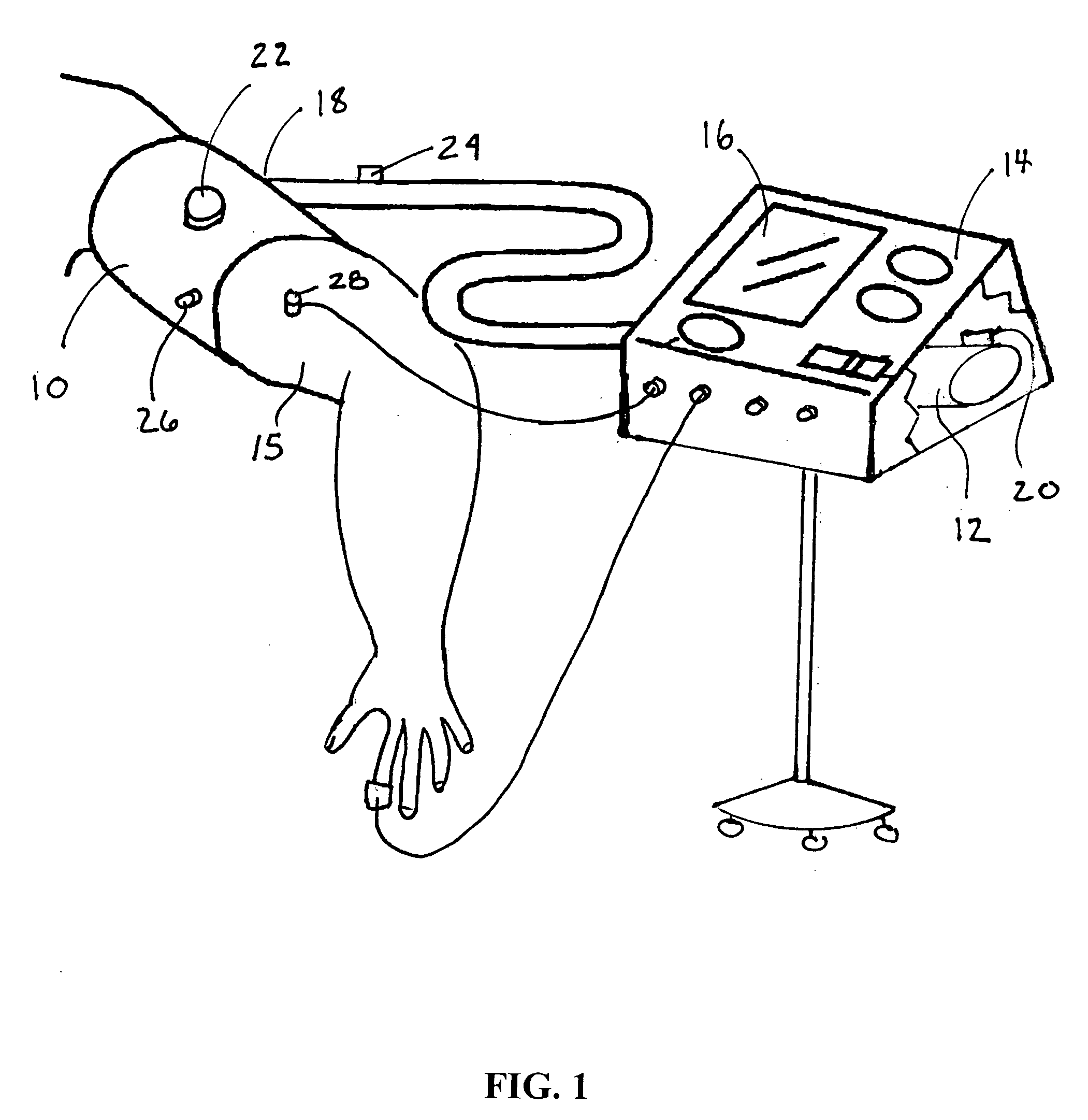 System for performing remote ischemic preconditioning