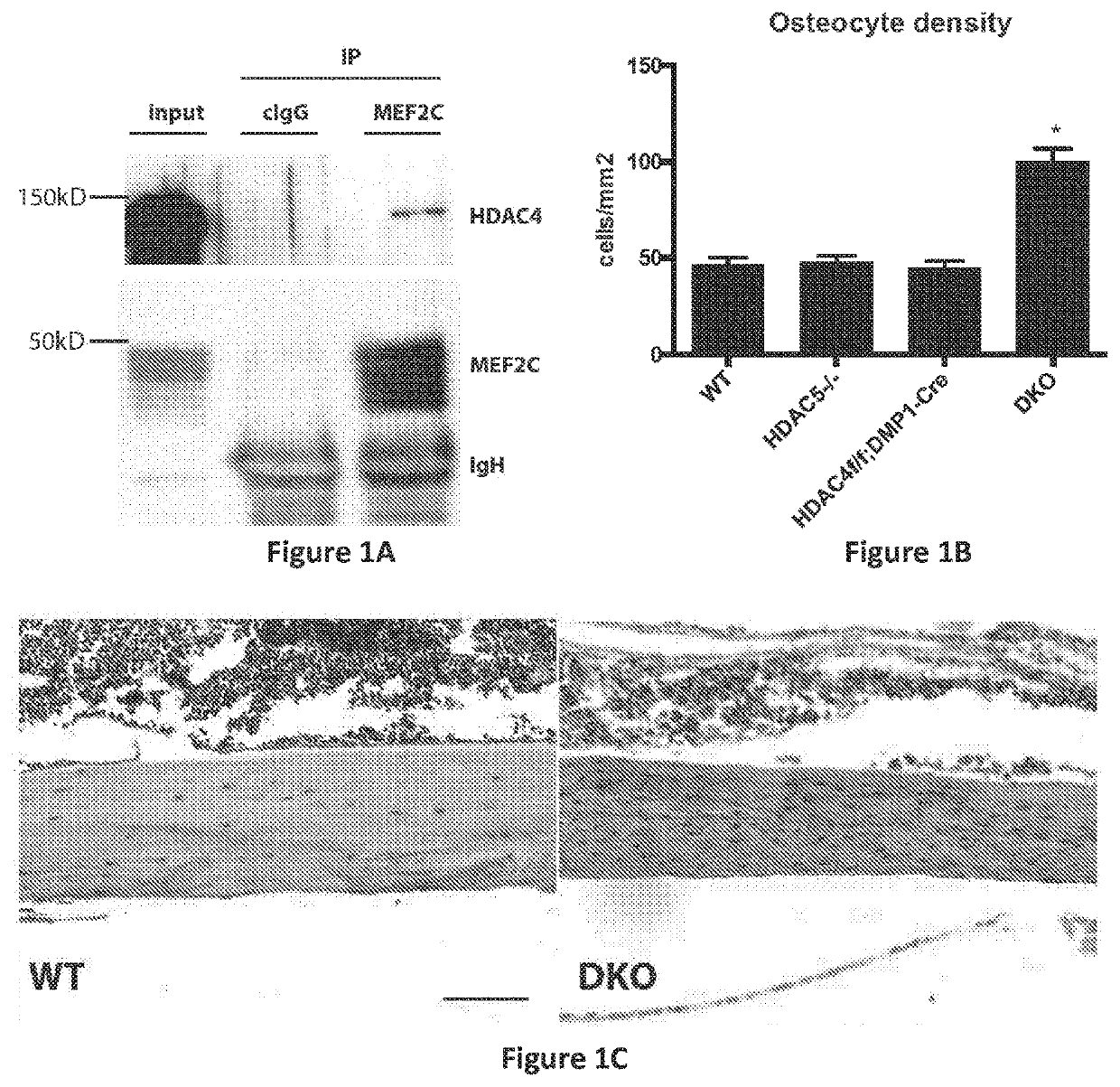 Uses of salt-inducible kinase (SIK) inhibitors for treating osteoporosis