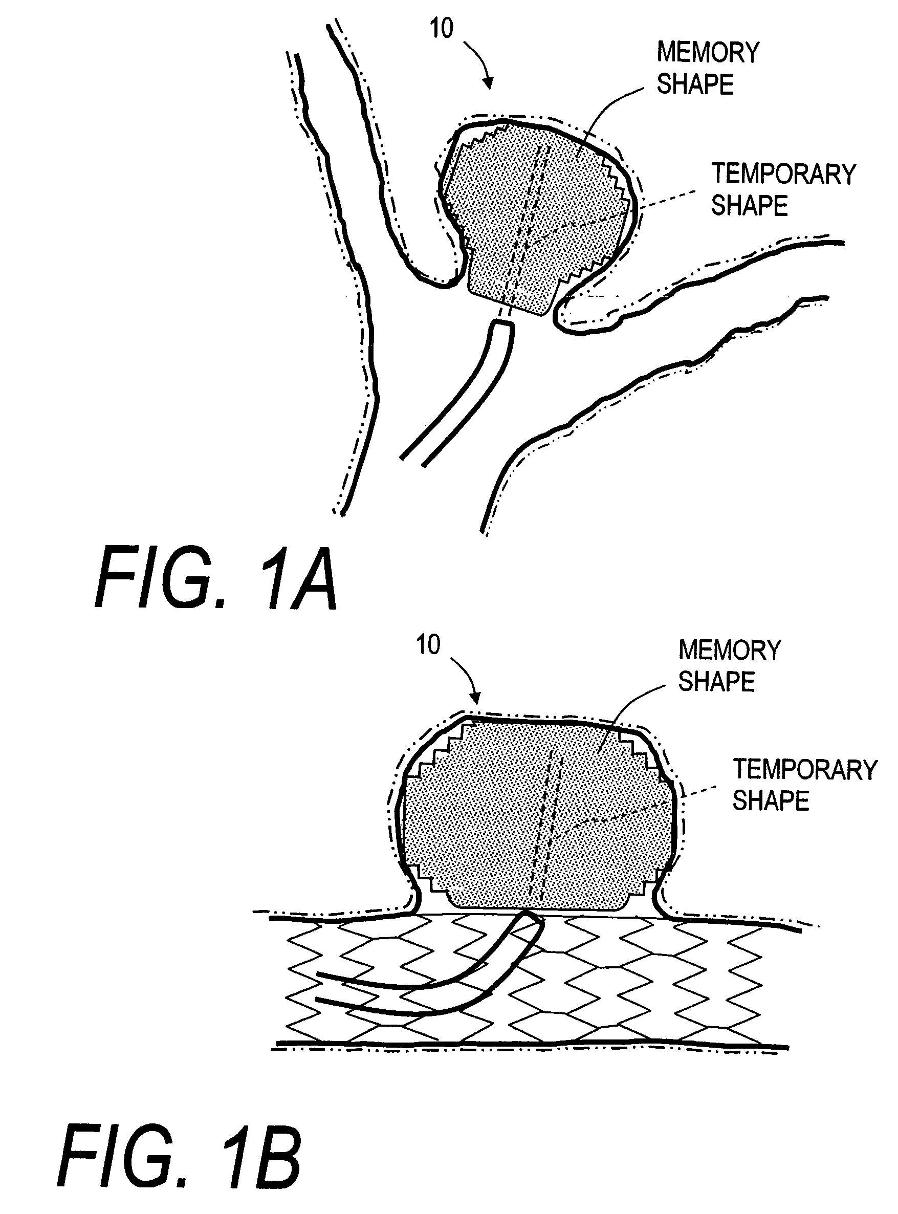 Endovascular occlusion devices and methods of use