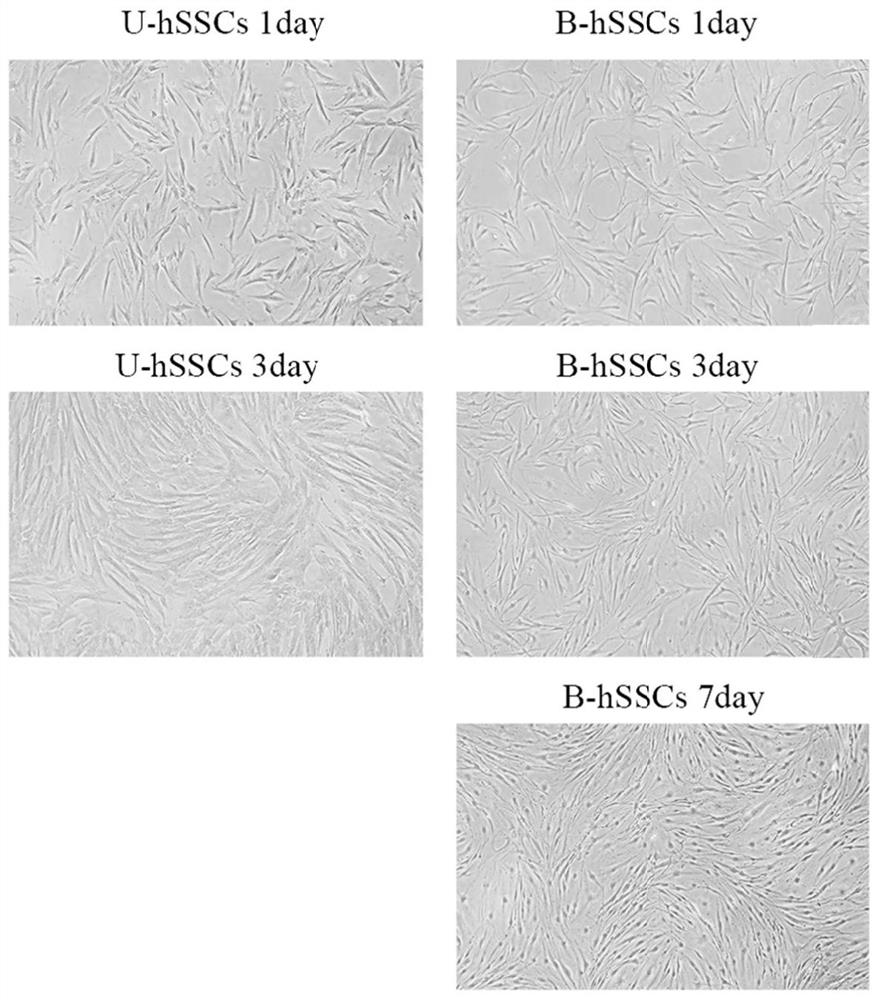 Method for extracting and separating umbilical cord-derived skeletal stem cells