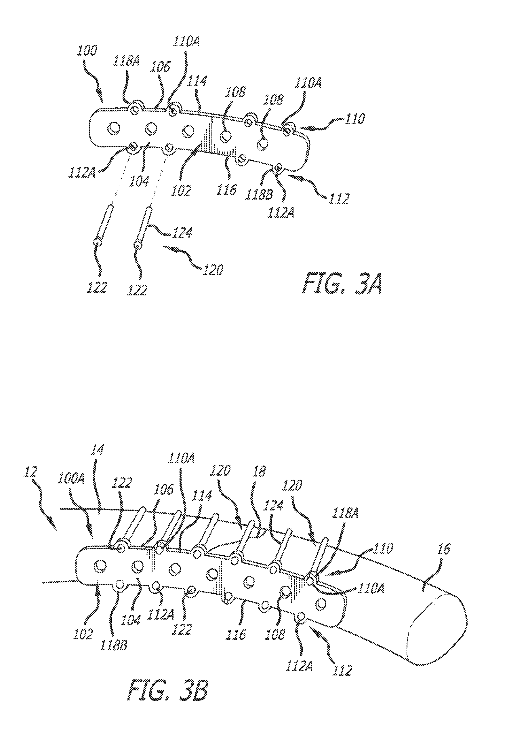 Modular and non-modular cortical buttress device