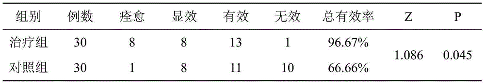 Traditional Chinese medicine preparation for treating migraine and preparation method thereof