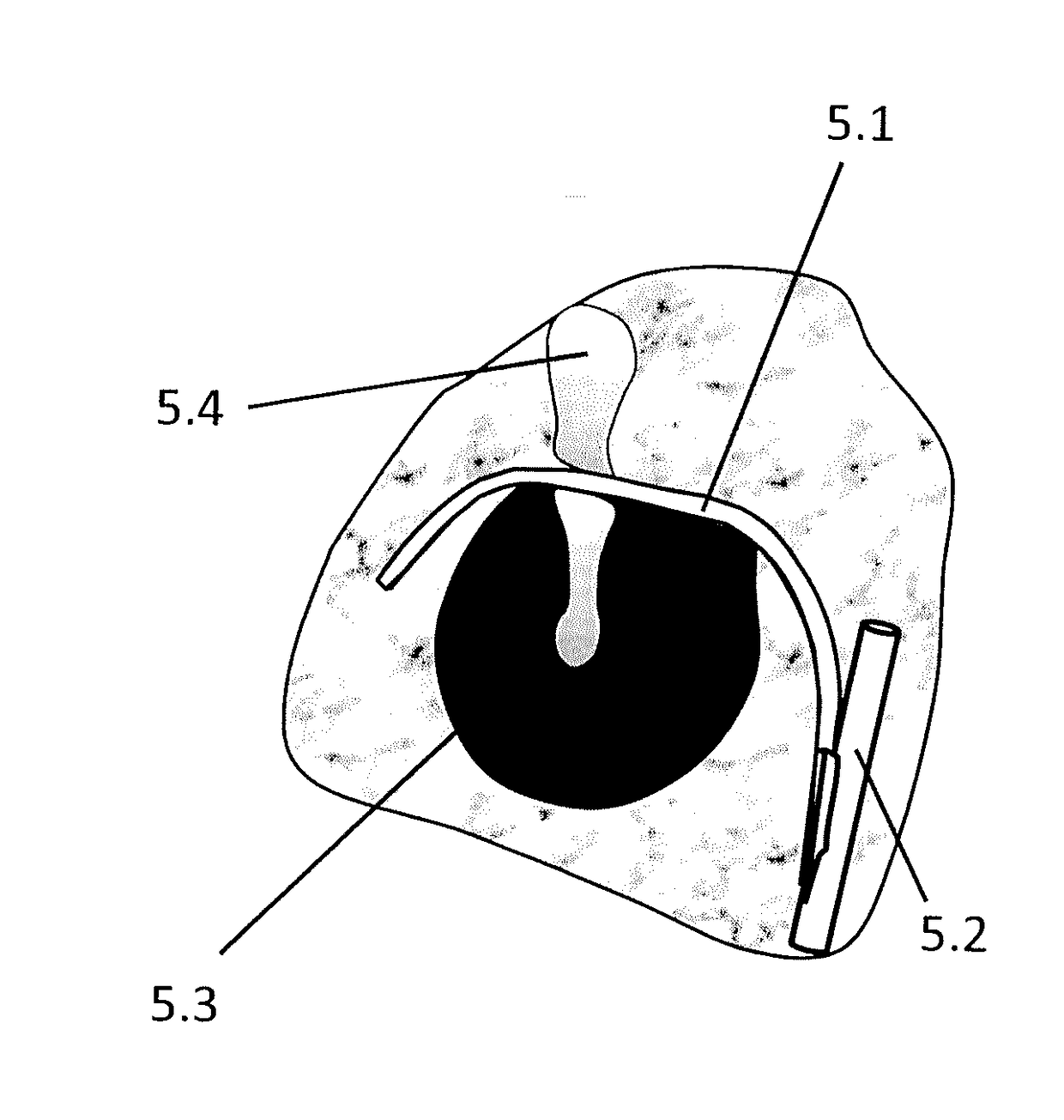 Wireless implantable taste system