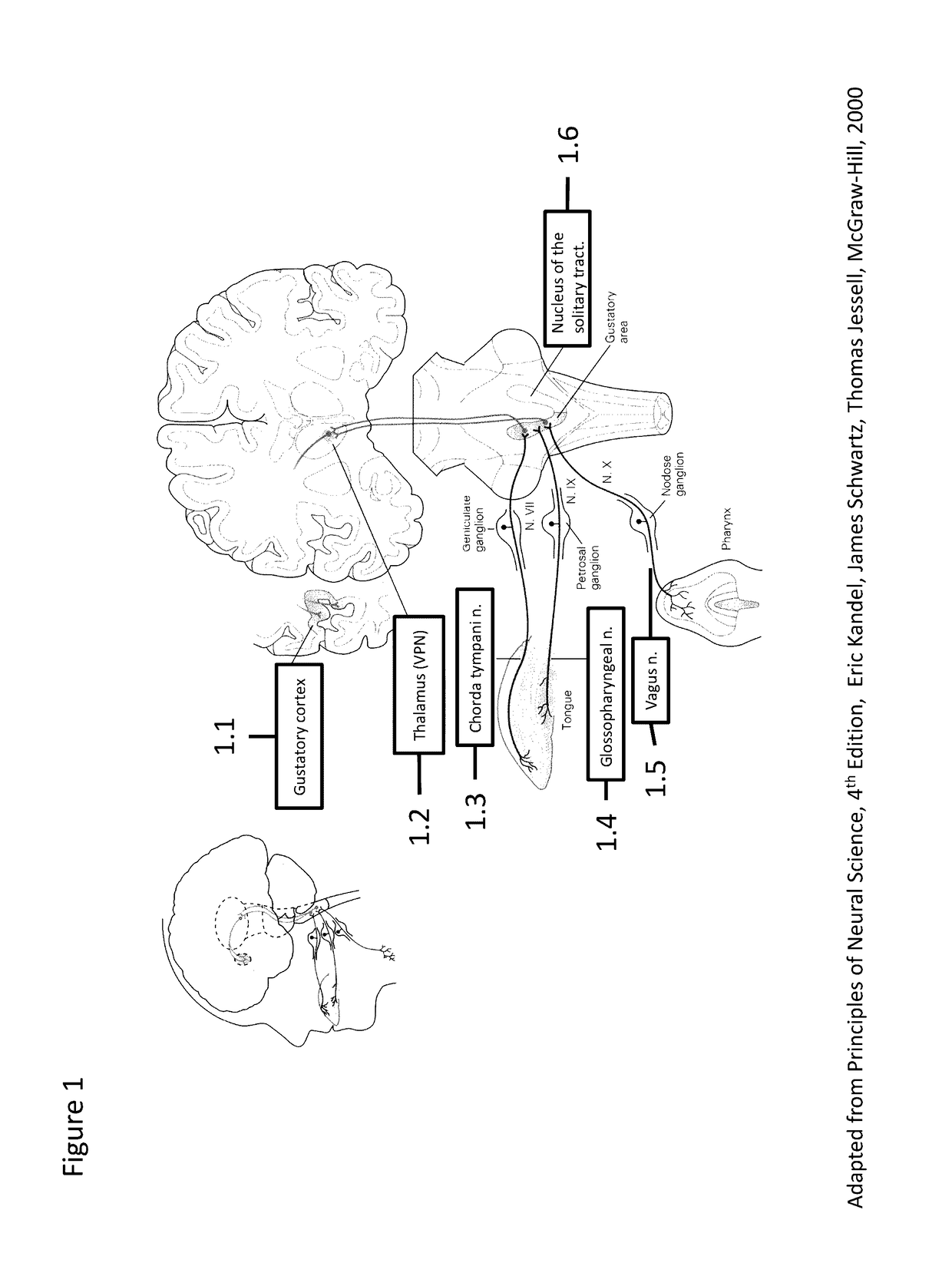 Wireless implantable taste system