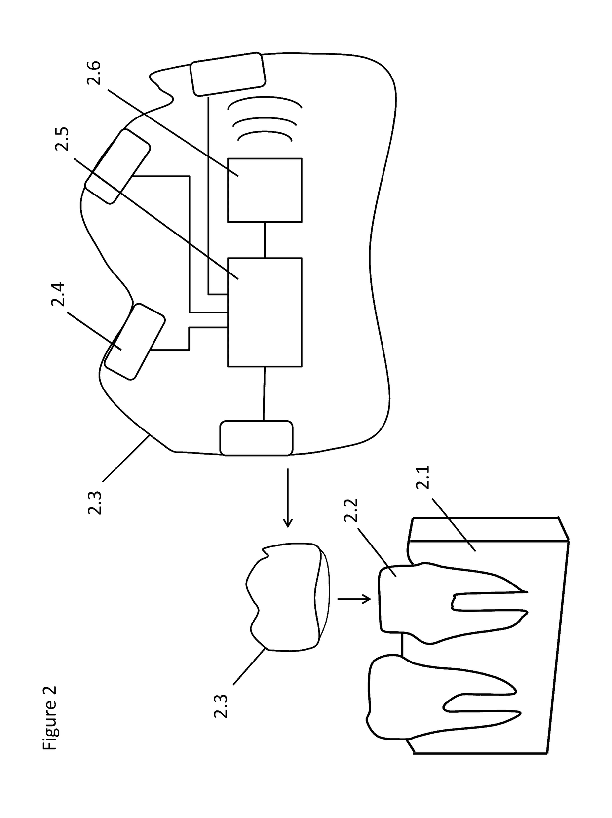 Wireless implantable taste system