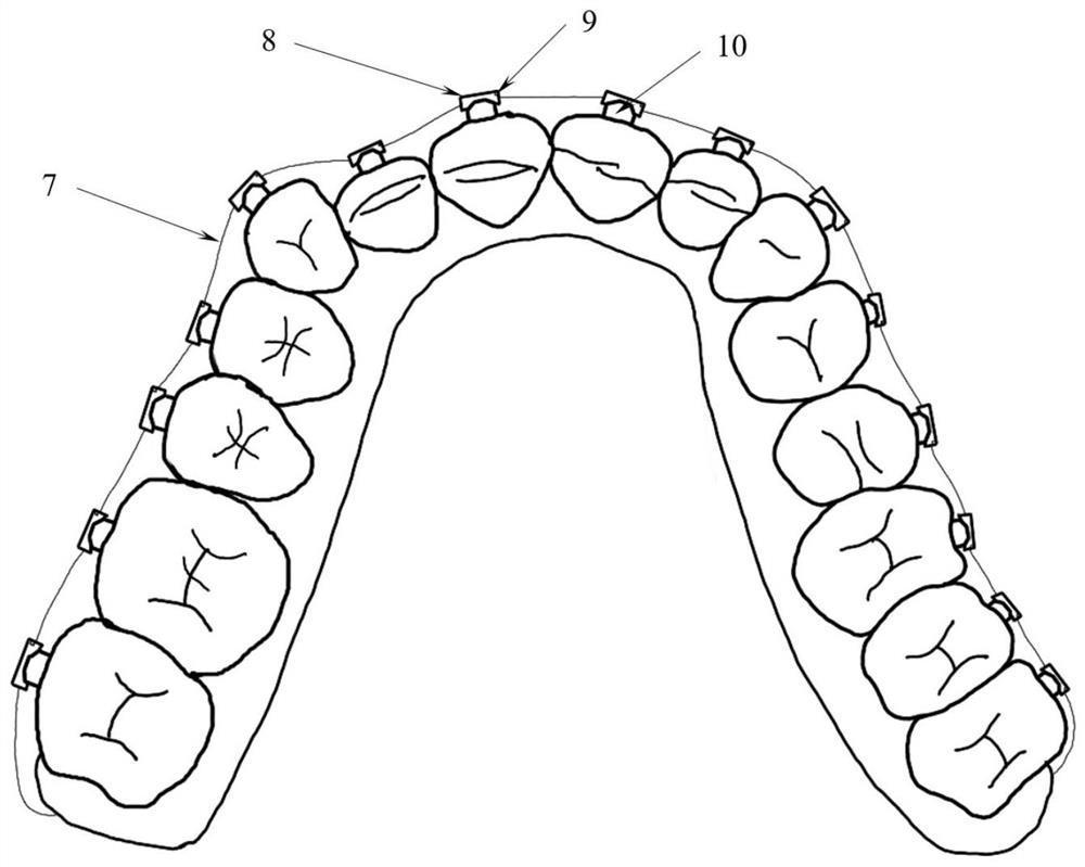Orthodontic force measuring device based on flexible six-dimensional force sensor