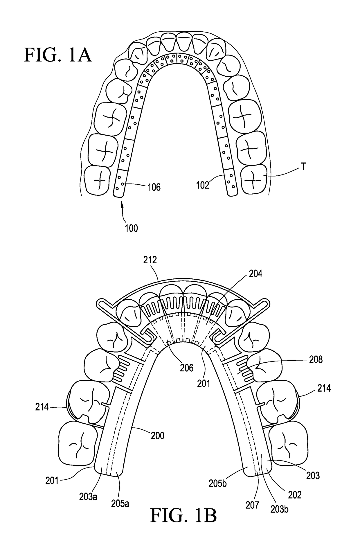 Orthodontic assembly