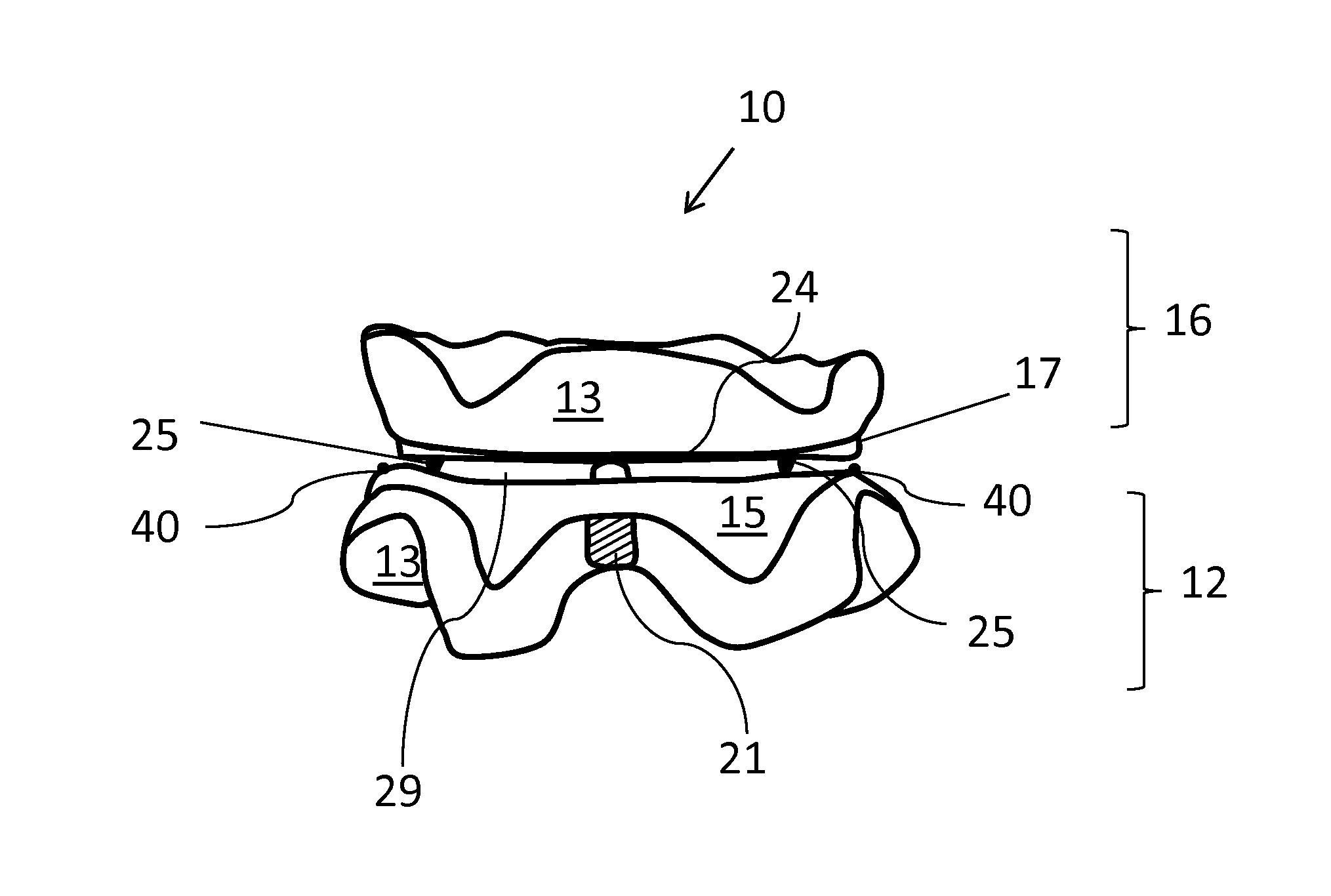 Intra Oral Dental Motion Recording Device and Method for the Digital Diagnosis, Computer Design and Manufacture of Dental Devices