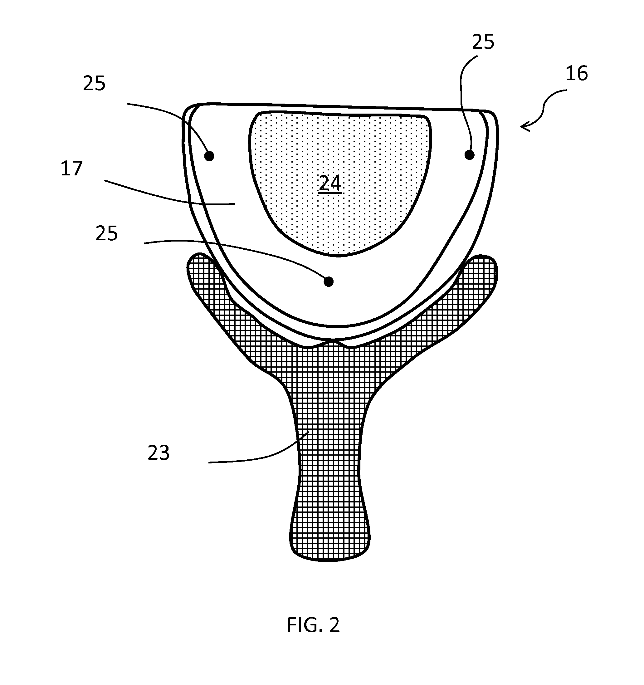 Intra Oral Dental Motion Recording Device and Method for the Digital Diagnosis, Computer Design and Manufacture of Dental Devices