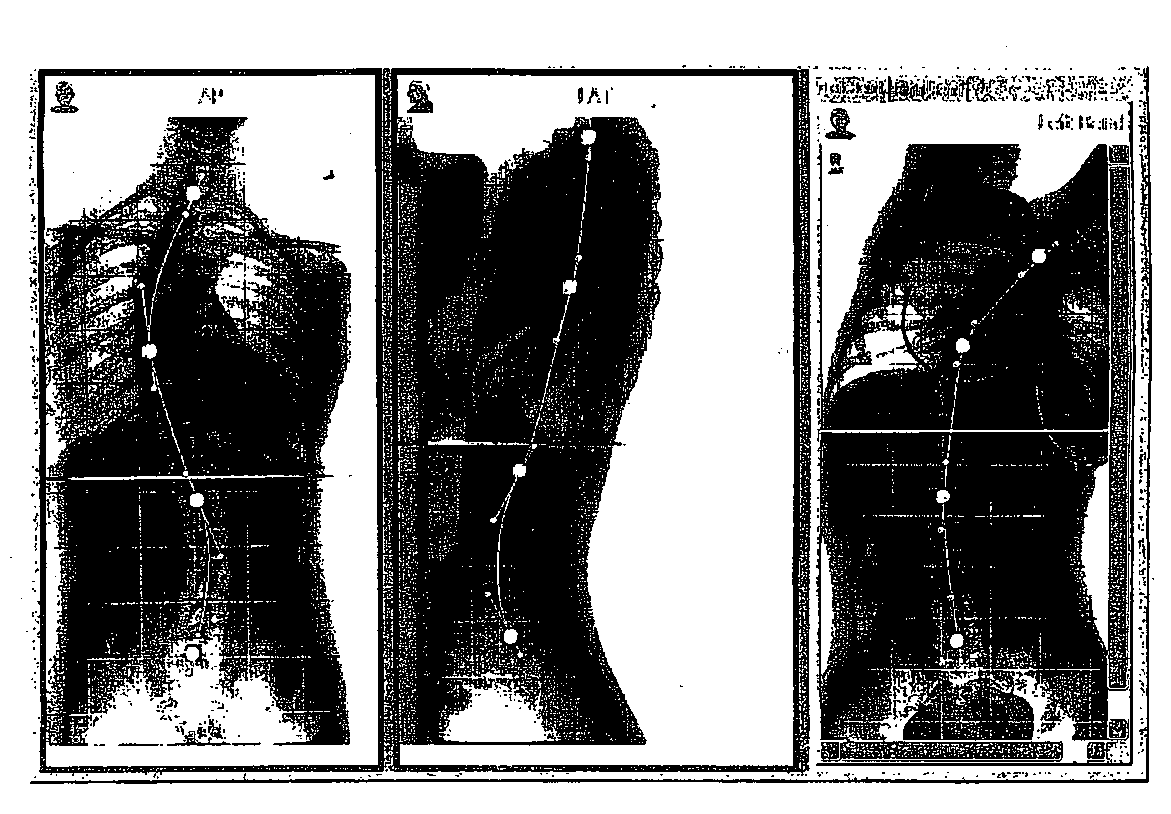 Systems and methods for multi-dimensional characterization and classification of spinal shape