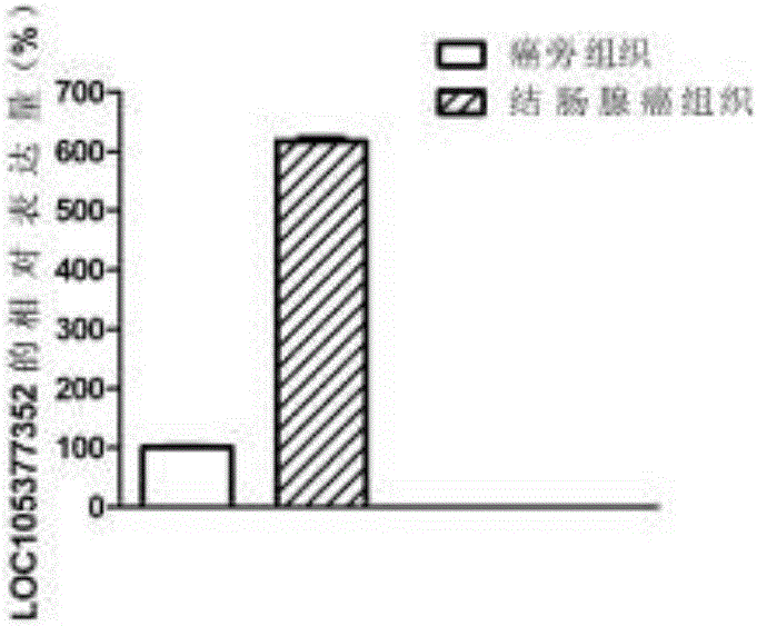 Molecular marker for colon adenocarcinoma