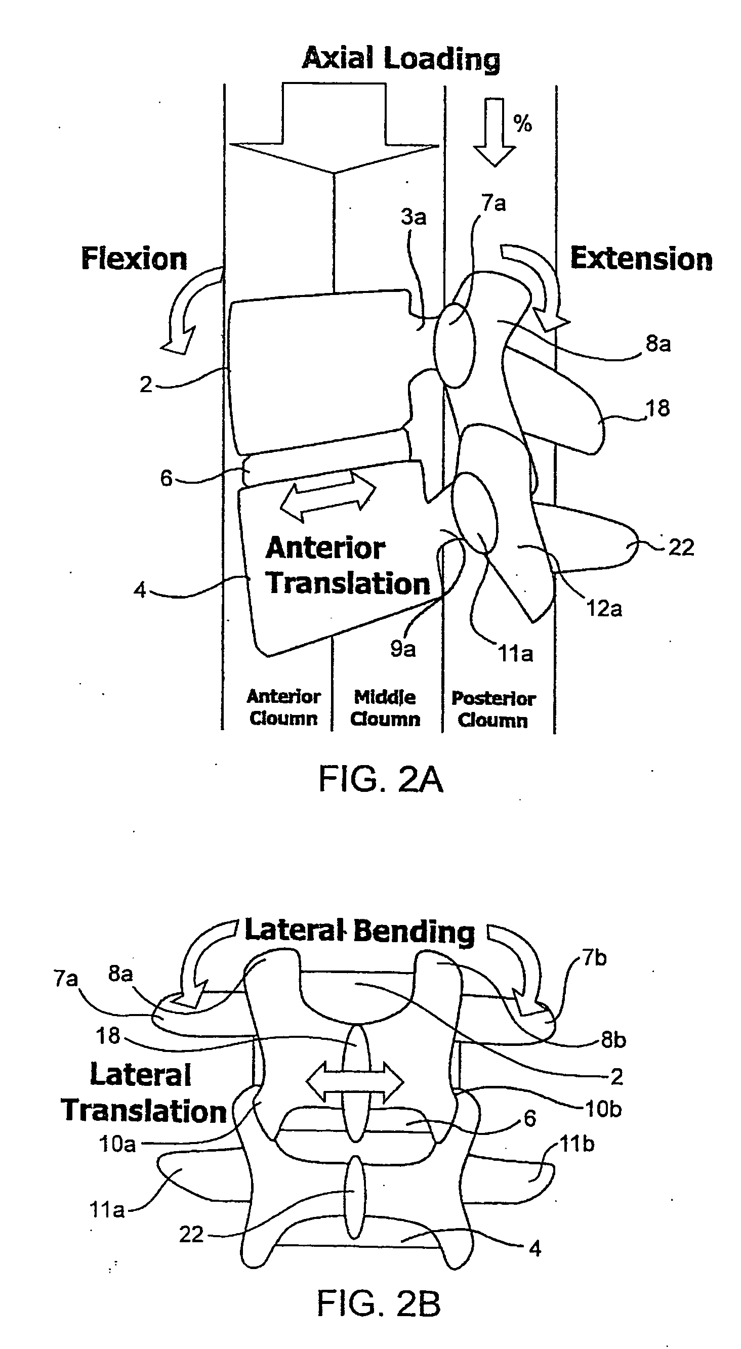 Systems and methods for stabilization of bone structures