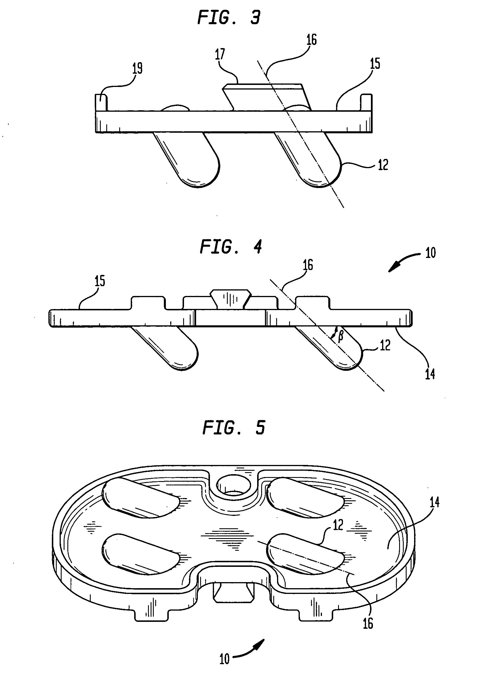 Orthopedic implant with angled pegs