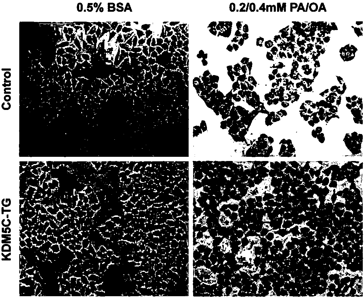 Application of histone demethylase KDM5C (lysine(K) demethylase 5C) in screening of drugs for treating the fatty liver and related diseases of the fatty liver