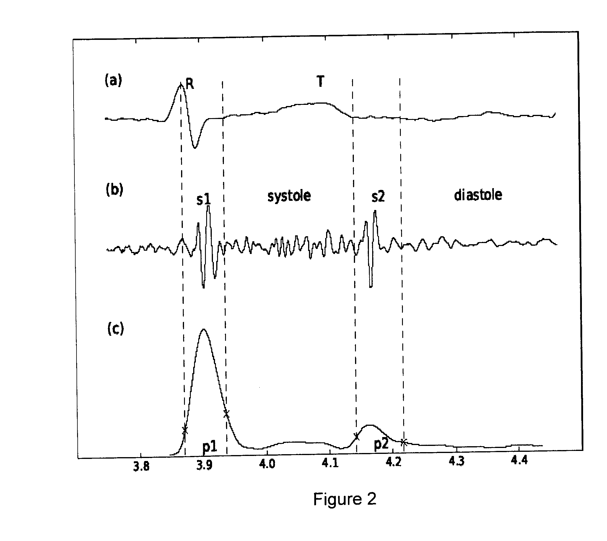 System and method for classifying a heart sound