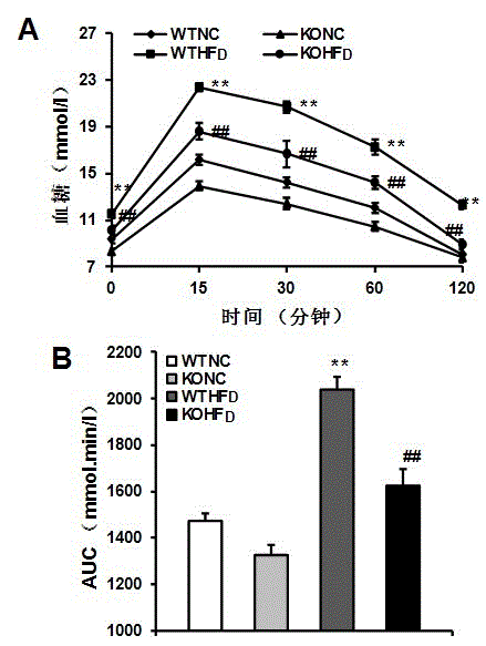 Function and application of tumor necrosis factor (TNF) receptor associated factor 1 (TRAF1) in treatment of fatty liver and diabetes mellitus II