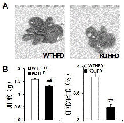 Function and application of tumor necrosis factor (TNF) receptor associated factor 1 (TRAF1) in treatment of fatty liver and diabetes mellitus II