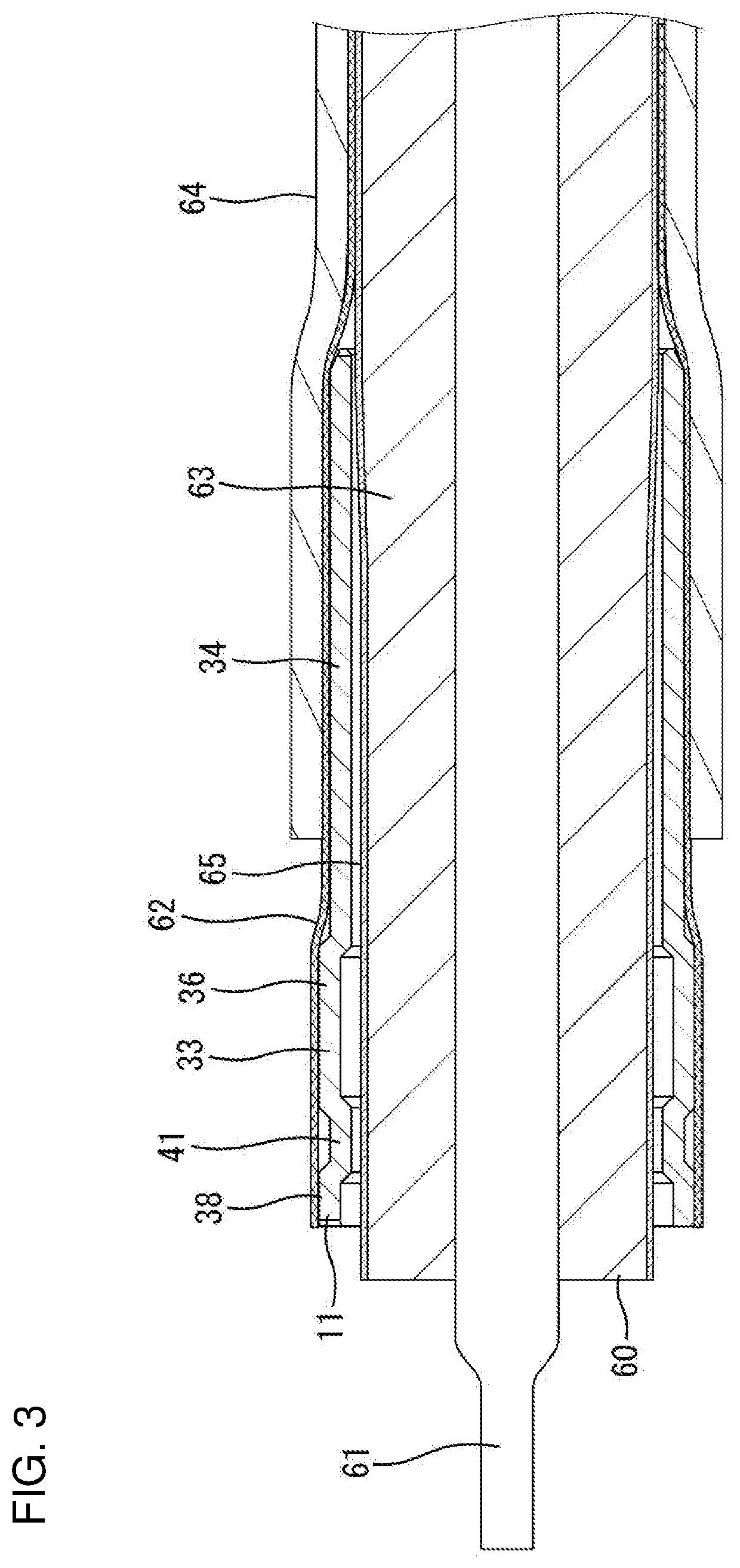 Sleeve and shield terminal manufacturing method