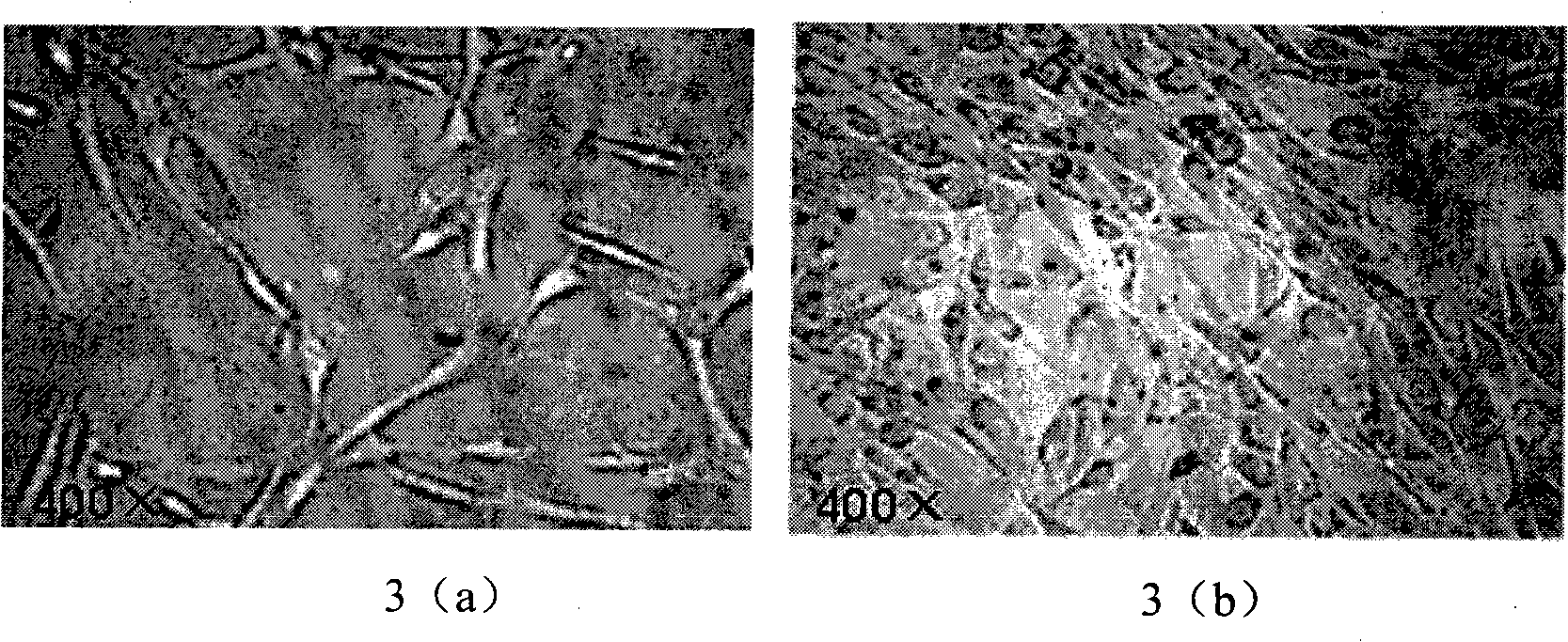 Acetobacter xylinum and method for preparing nano-cellulose skin tissue repair material by using the same