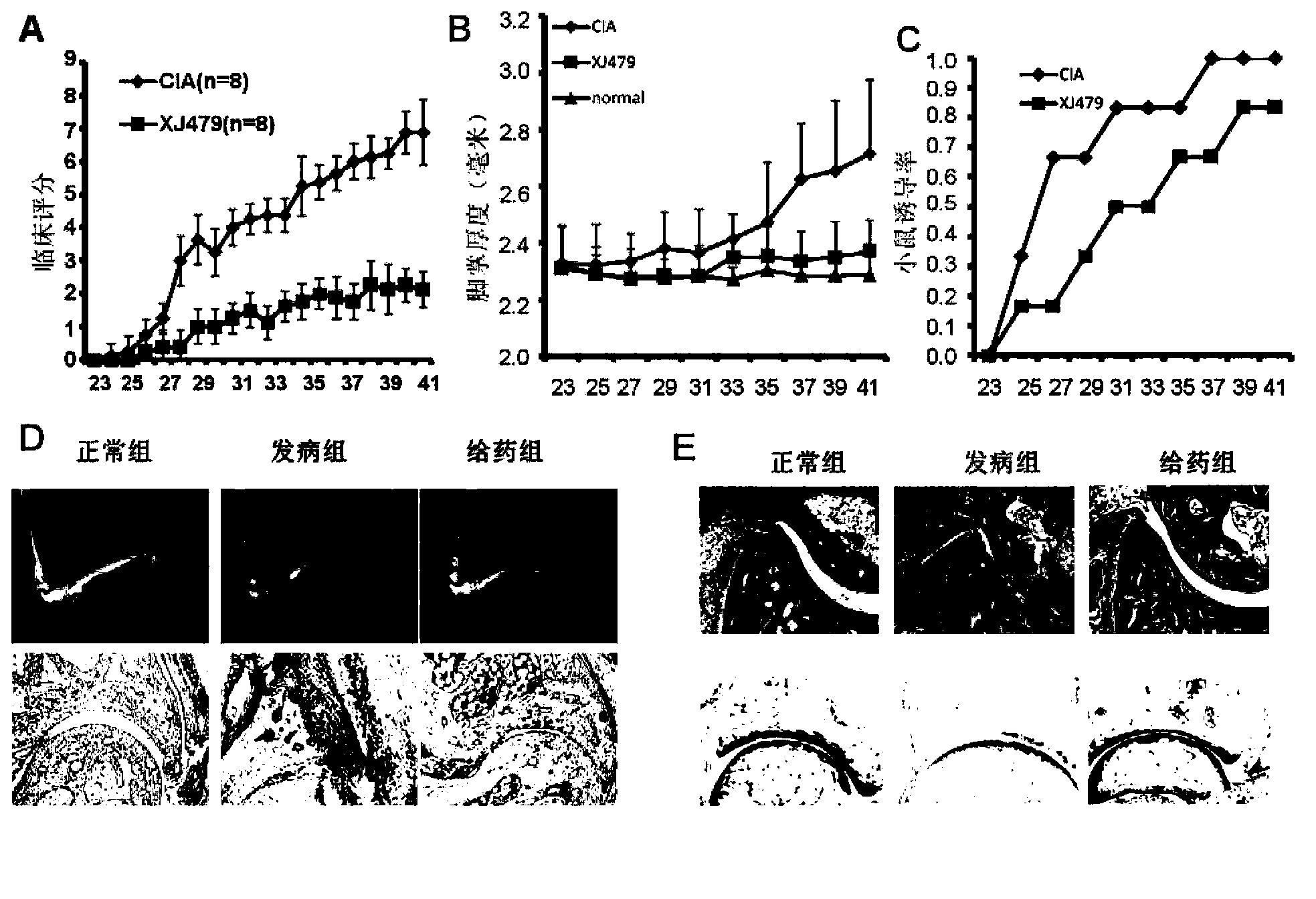 Application of betulinic acid derivatives in preparation of drugs inhibiting T cell differentiation